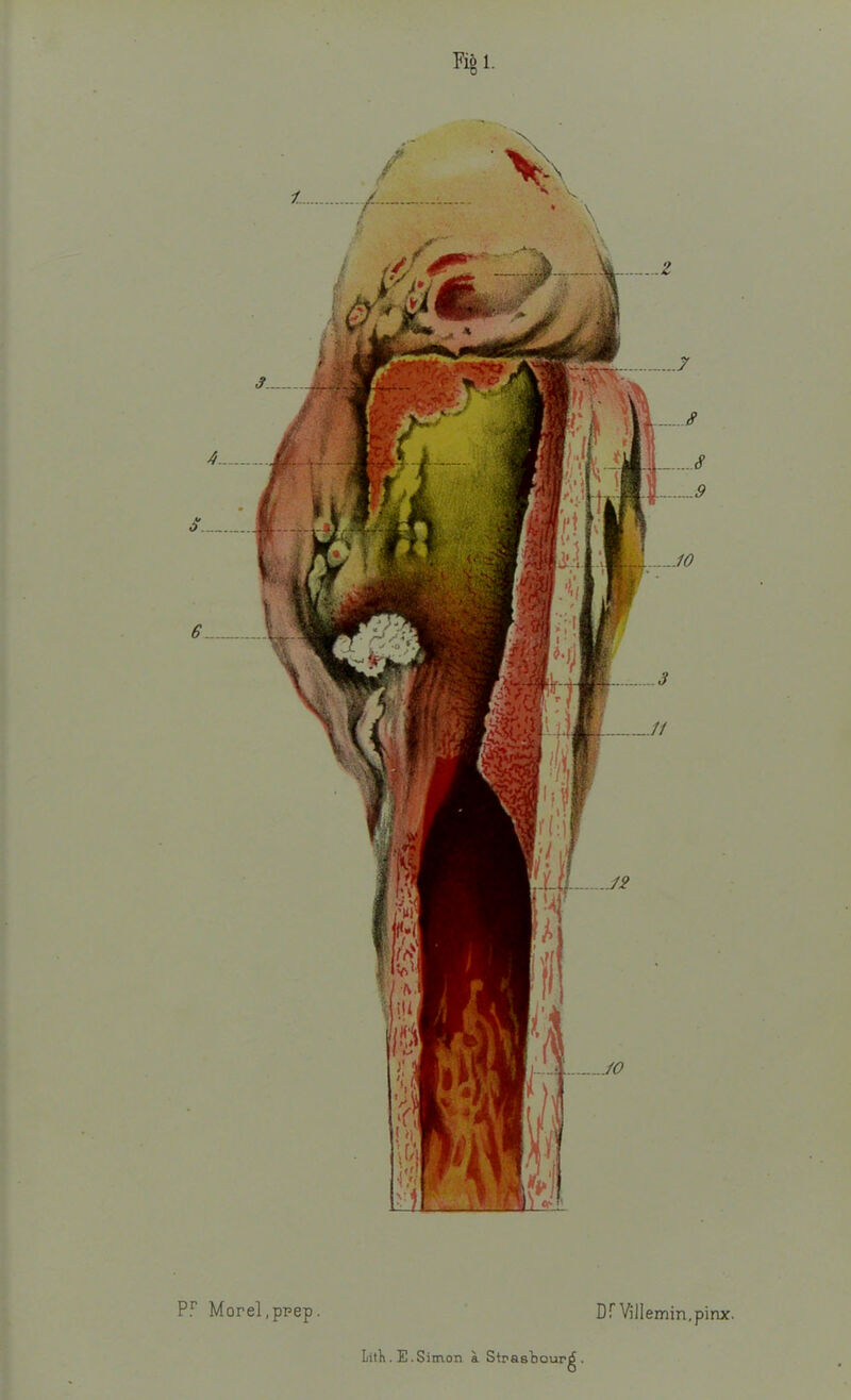 Fié 1- P.r Morel ,ppep. Df Villemin.pinx.