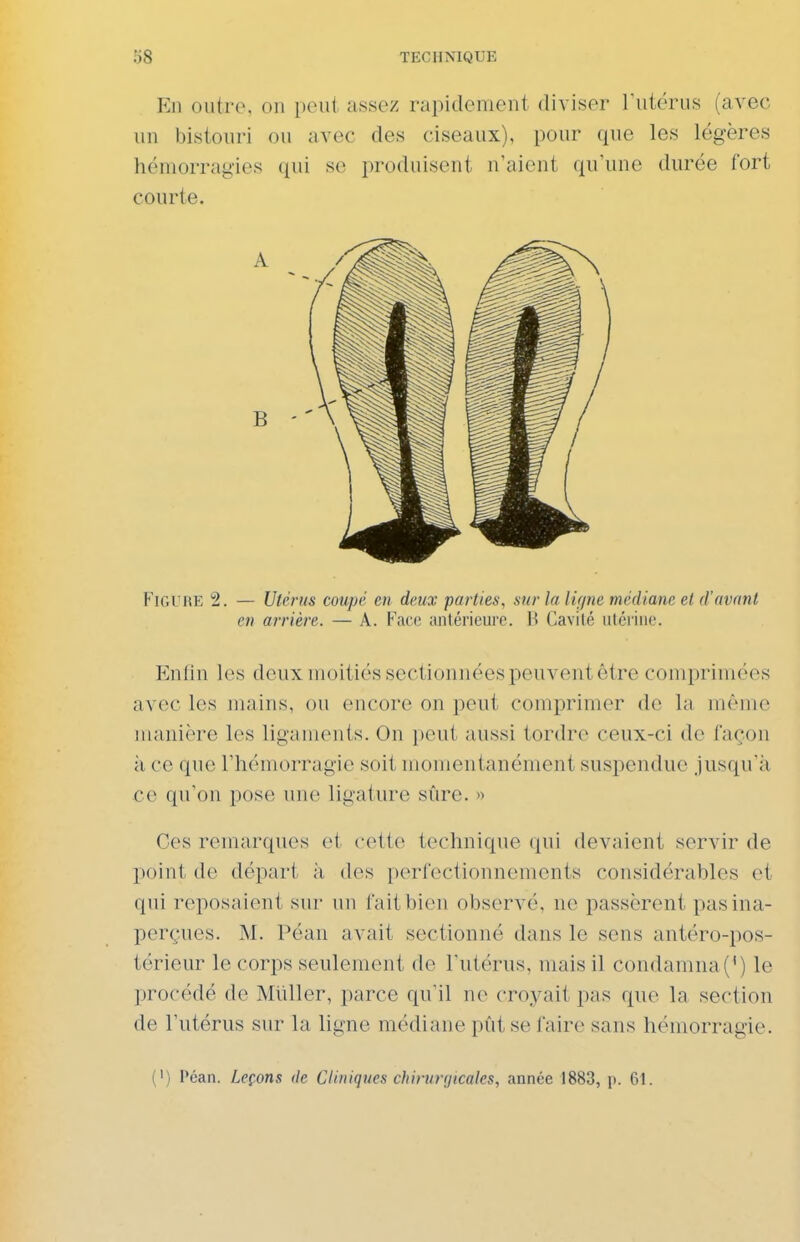 En outre, on peut assez rapidement diviser Tutérus (avec un bistouri ou avec des ciseaux), pour que les légères hémorragies qui se produisent n'aient quime durée fort courte. Figure 2. — Utérus coupé en deux parties, sur la iifjne médiane et d'avant en arrière. — A. Face antérieure. H Cavité utérine. Enfin l(^s deux moitiés sectionnées peuvent être comprimées avec les mains, ou encore on peut comprimer de la même manière les liganienis. On ])eut aussi tordre ceux-ci de façon à ce que l'hémorragie soit momentanément suspendue jusqu'à ce qu'on pose luie ligature sûre. » Ces remarques et cette technique (j[ui devaient servir de point de départ à des perfectionnements considérables et qui reposaient sur un fait bien observé, ne passèrent pas ina- perçues. M. Péan avait sectionné dans le sens antéro-pos- térieur le corps seulement de Futérus, mais il condamna(^) le procédé de Muller, parce qu'il ne croyait pas que la section de l'utérus sur la ligne médiane pût se faire sans hémorragie. (•) Péan. Leçons de Cliniques chirurgicales, année 1883, p. 61.