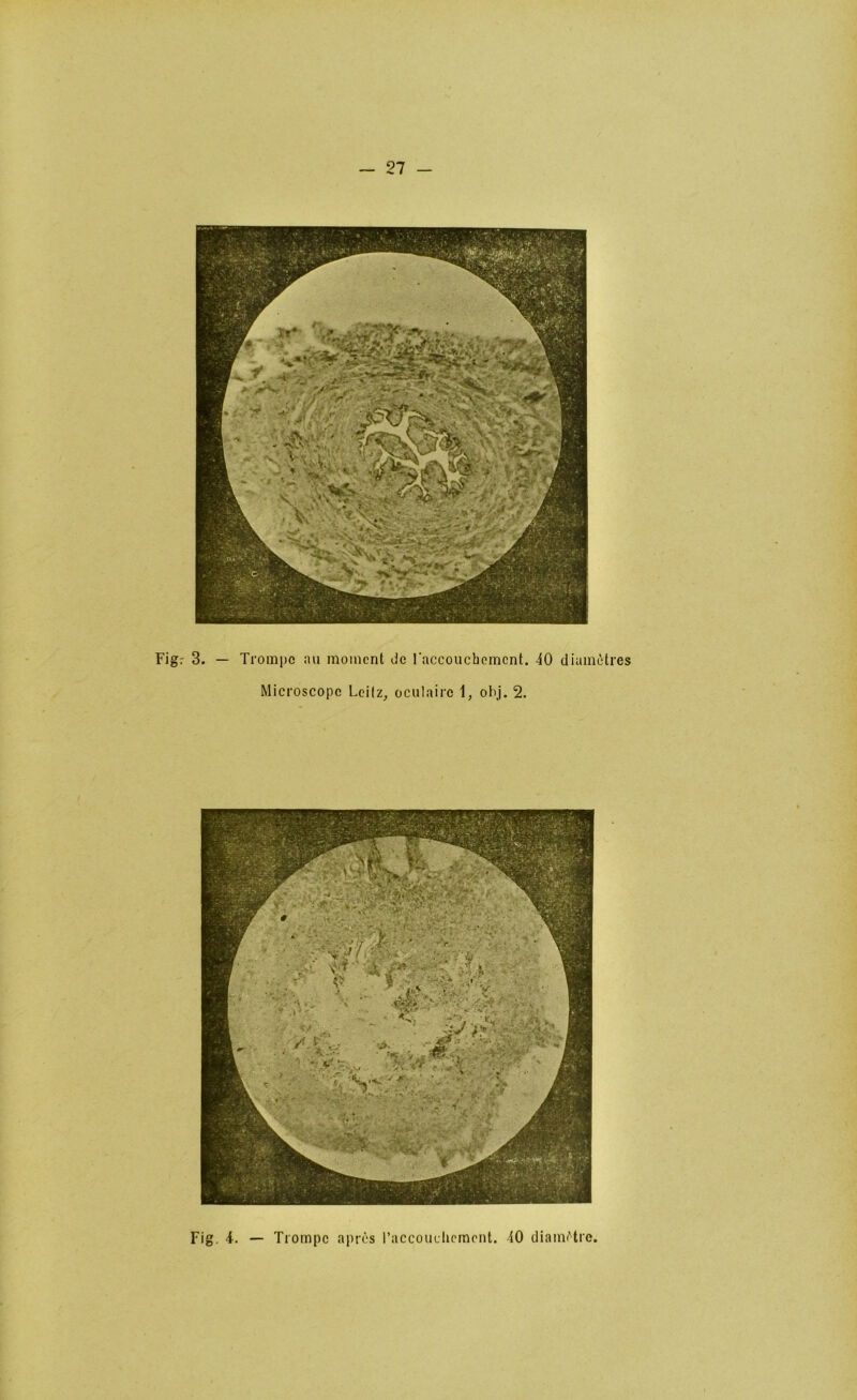 Figr 3. — Trompe nu moment de raccoucbomcnt. 40 diamùtres Microscope Leilz, oculaire 1, ohj. 2.