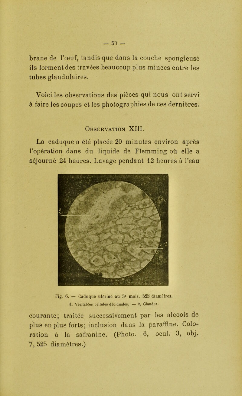 brane de l’œuf, tandis que dans la couche spongieuse ils forment des travées beaucoup plus minces entre les tubes glandulaires. Voici les observations des pièces qui nous ont servi à faire les coupes et les photographies de ces dernières. Observation XIII. La caduque a été placée 20 minutes environ après l’opération dans du liquide de Flemming où elle a séjourné 24 heures. Lavage pendant 12 heures à l’eau Fig. 6. — Caduque ulérine au 3« mois. 525 diamètres. Véritables cellules déciduales. — 2. Glandes. courante; traitée successivement par les alcools de plus en plus forts; inclusion dans la paraffine. Colo- ration à la safranine. (Photo. 6, ocul. 3, obj. 7, 525 diamètres.)