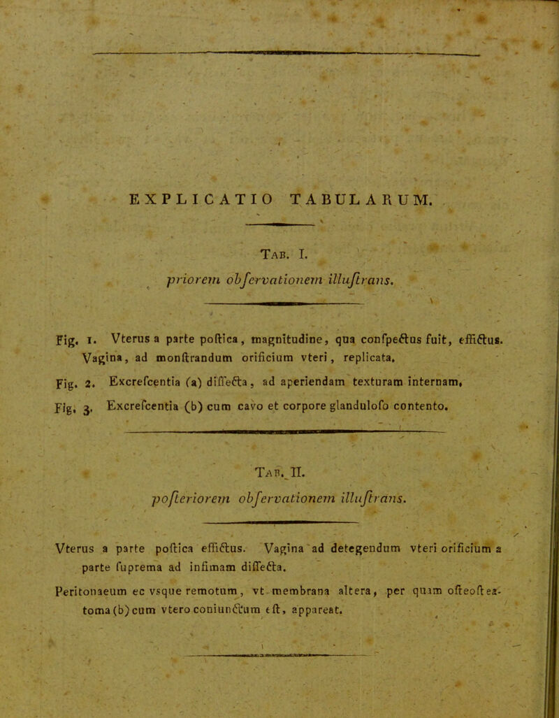 EXPLICATIO TABULARUM.'. Tab. I. V ■ t ■ —, ^ - priorem ohfervationem illujh;ans. ~ ^ * * - ll V ' ' * Fig. !• Vterus a parte poftica, magnitudine, qua confpeftus fuit, effiftus. Vagina, ad monftrandum orificium vteri, replicata, Fig* 2* Excrefcentia fa) dififefta, adaperiendam texturam internam» fjg; Excrefcentia (b) cum cavo et corpore glandulofo contento. • ■ - ^ • ' '/ , n ' Tab;ji. - , ‘ pofteriorem obfervationem illujtrans. ' ^ Vterus a parte poftica ’ effiftus. 'Vagina'ad detegendum vteri orificium a parte fuprema ad infimam diflefta. Peritonaeum ec vsque remotum, vt-roembrana altera, per quamoftepftea- toma(b)cum vteroconiunfl*um eft, appareat. ' >