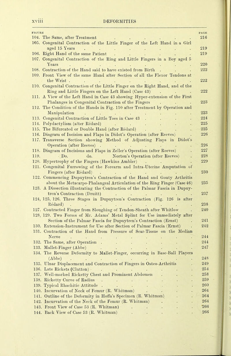 FIGURE 104. The Same, after Treatment ...... 105. Congenital Contraction of the Little Finger of the Left Hand in a Girl aged 15 Years ........ 106. Right Hand of the same Patient ...... 107. Congenital Contraction of the Ring and Little Fingers in a Boy aged 5 Years ......... 108. Contraction of the Hand said to have existed from Birth 109. Front View of the same Hand after Section of all the Flexor Tendons at the Wrist ......... 110. Congenital Contraction of the Little Finger on the Right Hand, and of the Ring and Little Fingers on the Left Hand (Case 43) 111. A View of the Left Hand in Case 43 showing Hyper-extension of the First Phalanges in Congenital Contraction of the Fingers 112. The Condition of the Hands in Fig. 110 after Treatment by Operation and Manipulation ........ 113. Congenital Contraction of Little Toes in Case 43 . . . . 114. Polydactylism (after Redard) ...... 115. The Bifurcated or Double Hand (after Redard) .... 116. Diagram of Incision and Flaps in Didot’s Operation (after Reeves) 117. Transverse Section showing Method of Adjusting Flaps in Didot’s Operation (after Reeves) ....... 118. Diagram of Incisions and Flaps in Zeller’s Operation (after Reeves) 119. Do. do. Norton’s Operation (after Reeves) 120. Hypertrophy of the Fingers (Hawkins Ambler) .... 121. Congenital Furrowing of the Forearm and Intra-Uterine Amputation of Fingers (after Redard) ....... 122. Commencing Dupuytren’s Contraction of the Hand and Gouty Arthritis about the Metacarpo-Phalangeal Articulation of the Ring Finger (Case 46) 123. A Dissection illustrating the Contraction of the Palmar Fascia in Dupuy- tren’s Contraction (Druitt) ...... 124. 125, 126. Three Stages in Dupuytren’s Contraction (Fig. 126 is after Redard) ......... 127. Contracted Finger from Sloughing of Tendon-Sheath after Whitlow 128, 129. Two Forms of Mr. Adams’ Metal Splint for Use immediately after Section of the Palmar Fascia for Dupuytren’s Contraction (Ernst) 130. Extension-Instrument for Use after Section of Palmar Fascia (Ernst) 131. Contraction of the Hand from Pressure of Scar-Tissue on the Median Nerve ......... 132. The Same, after Operation ....... 133. Mallet-Finger (Abbe) ....... 134. The Reverse Deformity to Mallet-Finger, occurring in Base-Ball Players (Abbe) ......... 135. Ulnar Displacement and Contraction of Fingers in Osteo-Arthritis 136. Late Rickets (Clutton) ........ 137. Well-marked Ricketty Chest and Prominent Abdomen 138. Ricketty Curve of Radius ....... 139. Typical Rhachitic Attitude ....... 140. Incurvation of Neck of Femur (R. Whitman) .... 141. Outline of the Deformity in Hoffa’s Specimen (R. Whitman) 142. Incurvation of the Neck of the Femur (R. Whitman) 143. Front View of Case 53 (R. Whitman) . 144. Back View of Case 53 (R. Whitman) . . . . . PAGE 216 219 219 220 222 222 222 223 223 224 225 225 226 226 227 228 229 230 235 237 238 240 241 242 244 244 247 248 249 254 258 259 260 264 264 264 266 266