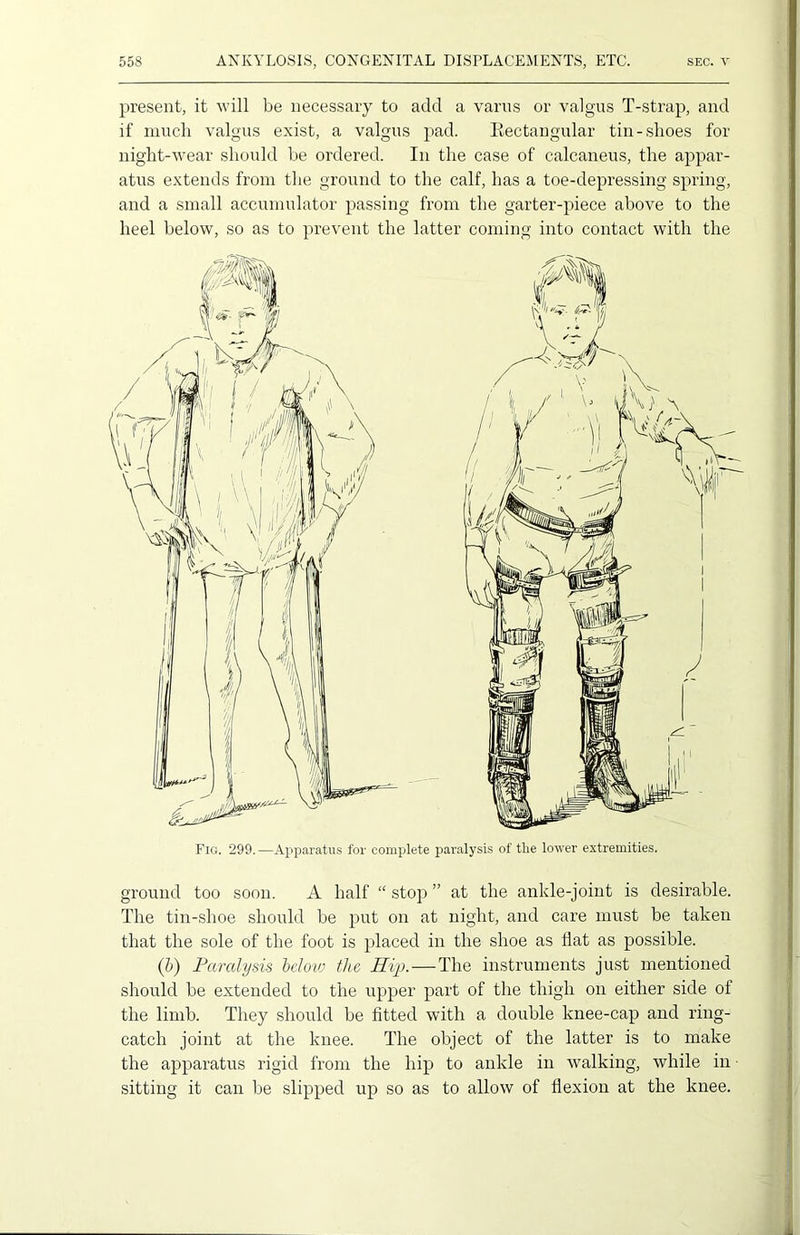 present, it will be necessary to add a varns or valgus T-strap, and if much valgus exist, a valgus pad. Rectangular tin-shoes for night-wear should be ordered. In the case of calcaneus, the appar- atus extends from the ground to the calf, has a toe-depressing spring, and a small accumulator passing from the garter-piece above to the heel below, so as to prevent the latter coming into contact with the Fig. 299. —Apparatus for complete paralysis of tlie lower extremities. ground too soon. A half “ stop ” at the ankle-joint is desirable. The tin-shoe should be put on at night, and care must be taken that the sole of the foot is placed in the shoe as flat as possible. (b) Paralysis below the Hip. — The instruments just mentioned should be extended to the upper part of the thigh on either side of the limb. They should be fitted with a double knee-cap and ring- catch joint at the knee. The object of the latter is to make the apparatus rigid from the hip to ankle in walking, while in sitting it can be slipped up so as to allow of flexion at the knee.