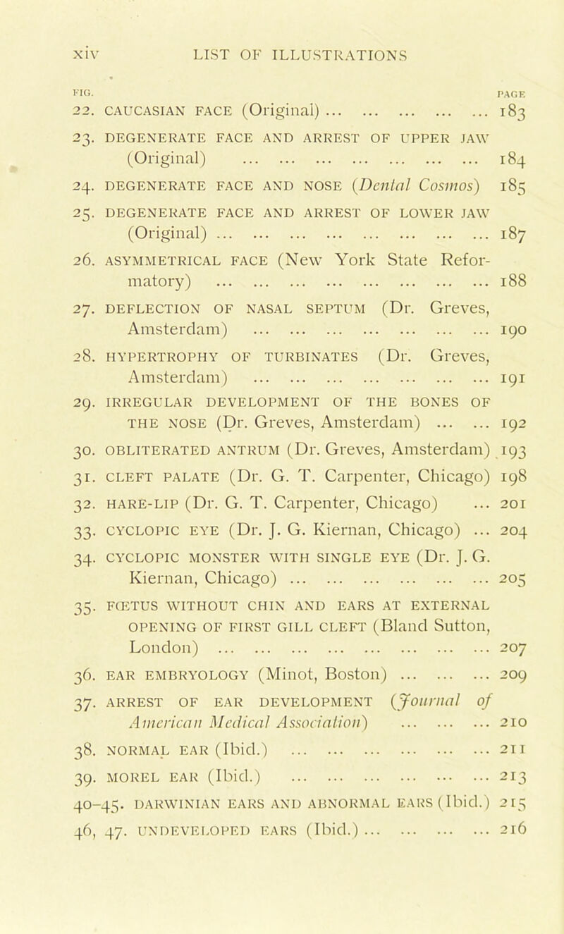 FIG. 22. CAUCASIAN face (Original) 23. DEGENERATE FACE AND ARREST OF UPPER JAW (Original) 24. DEGENERATE FACE AND NOSE (Denial Cosmos) 23. DEGENERATE FACE AND ARREST OF LOWER JAW (Original) 26. asymmetrical face (New York State Refor- matory) 27. deflection of nasal septum (Dr. Greves, Amsterdam) 28. HYPERTROPHY OF TURBINATES (Dr. Greves, Amsterdam) 29. IRREGULAR DEVELOPMENT OF THE BONES OF the nose (Dr. Greves, Amsterdam) 30. obliterated antrum (Dr. Greves, Amsterdam) 31. cleft palate (Dr. G. T. Carpenter, Chicago) 32. hare-lip (Dr. G. T. Carpenter, Chicago) 33. cyclopic eye (Dr. J. G. Kiernan, Chicago) ... 34. CYCLOPIC MONSTER WITH SINGLE EYE (Dr. J. G. Kiernan, Chicago) 35. FCETUS WITHOUT CHIN AND EARS AT EXTERNAL OPENING OF FIRST GILL CLEFT (Bland Slltton, London) 36. EAR EMBRYOLOGY (Miliot, Boston) 37. ARREST OF EAR DEVELOPMENT (Journal of American Medical Association) 38. NORMAL EAR (Ibid.) 39. MOREL EAR (Ibid.) 40-45. DARWINIAN EARS AND ABNORMAL EARS (Ibid.) 46, 47. UNDEVELOPED EARS (Ibid.) PAGE 183 184 185 187 188 190 191 192 A93 198 201 204 205 207 209 210 211 213 215 2r6