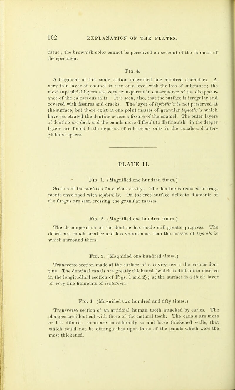 tissue ; the brownish color cannot be perceived on account of the thinness of the specimen. Fig. 4. A fragment of this same section magnified one hundred diameters. A very thin layer of enamel is seen on a level with the loss of substance; the most superficial layers are very transparent in consequence of the disappear- ance of the calcareous salts. It is seen, also, that the surface is irregular and covered with fissures and cracks. The layer of lepioihrix is not preserved at the surface, but there exist at one point masses of granular lepioihrix which have penetrated the dentine across a fissure of the enamel. The outer layers of dentine are dark and the canals more difiicult to distinguish ; in the deeper layers are found little deposits of calcareous salts in the canals and inter- globular spaces. PLATE II. Pig. 1. (Magnified one hundred times.) Section of the surface of a carious cavity. The dentine is reduced to frag- ments enveloped with lepioihrix. On the free surface delicate filaments of the fungus are seen crossing the granular masses. FiQ. 2. (Magnified one hundred times.) The decomposition of the dentine has made still greater progress. The debris are much smaller and less voluminous than the masses of lepioihrix which surround them. FiQ. 3. (Magnified one hundred limes.) Transverse section made at the surface of a cavity across the carious den- tine. The dentinal canals are greatly thickened (which is difficult to observe in the longitudinal section of Figs. 1 and 2) ; at the surface is a thick layer of very fine filaments of lepioihrix. Fig. 4. (Magnified two hundred and fifty times.) Transverse section of an artificial human tooth attacked by caries. The changes are identical with those of the natural teeth. The canals are more or less dilated; some are considerably so and have thickened walls, that which could not be distinguished upon those of the canals which were the most thickened.