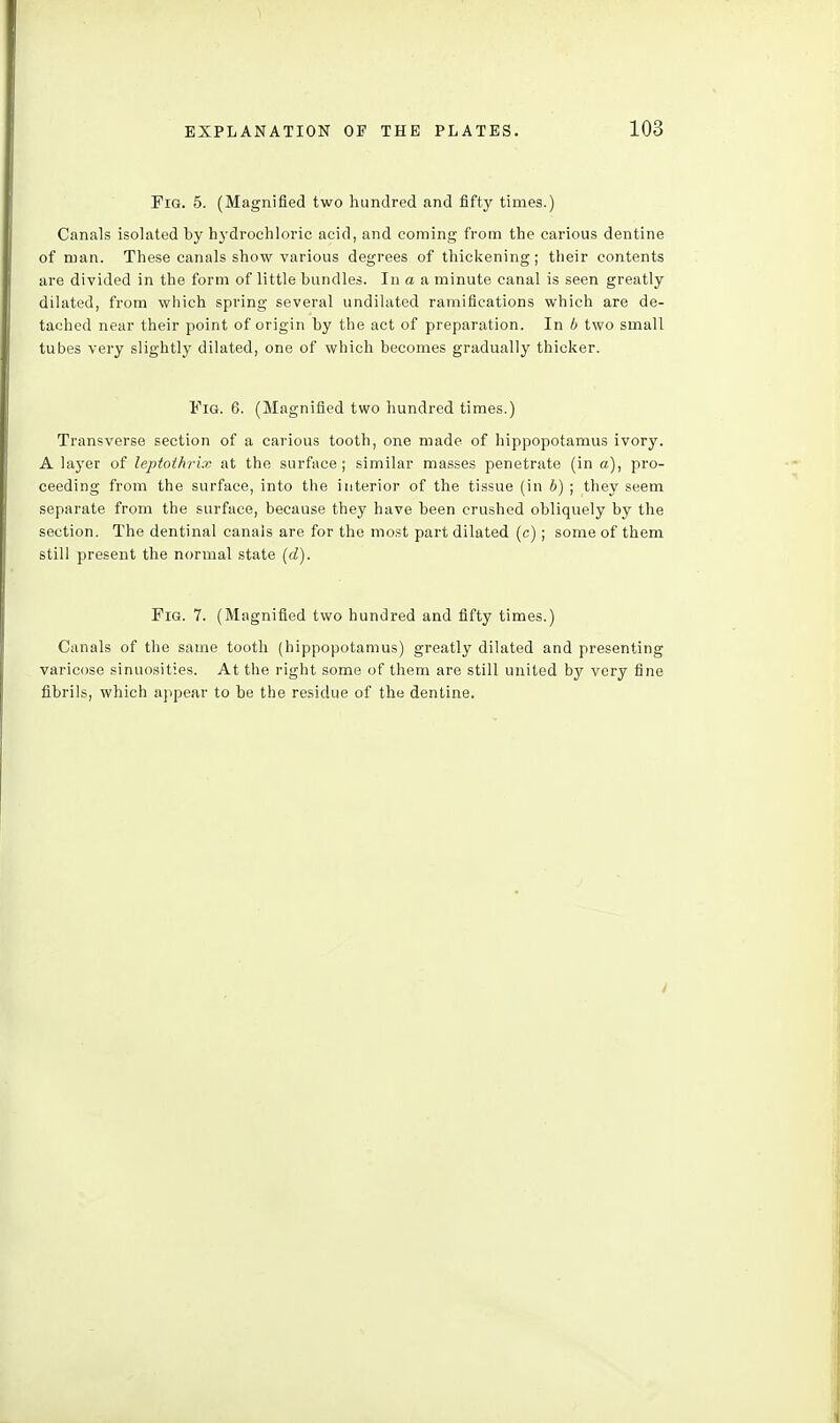 Pig. 5. (Magnified two hundred and fifty times.) Canals isolated by hydrochloric acid, and coming from the carious dentine of man. These canals show various degrees of thickening; their contents are divided in the form of little bundles. In a a minute canal is seen greatly dilated, from which spring several undilated ramifications which are de- tached near their point of origin by the act of preparation. In b two small tubes very slightly dilated, one of which becomes gradually thicker. Fig. 6, (Magnified two hundred times.) Transverse section of a carious tooth, one made of hippopotamus ivory. A layer of leptothrix at the surface; similar masses penetrate (in a), pro- ceeding from the surface, into the interior of the tissue (in 6) ; they seem separate from the surface, because they have been crushed obliquely by the section. The dentinal canais are for the most part dilated (c); some of them still present the normal state {d). Fig. 7. (Magnified two hundred and fifty times.) Canals of the same tooth (hippopotamus) greatly dilated and presenting varicose sinuosities. At the right some of them are still united by very fine fibrils, which appear to be the residue of the dentine.