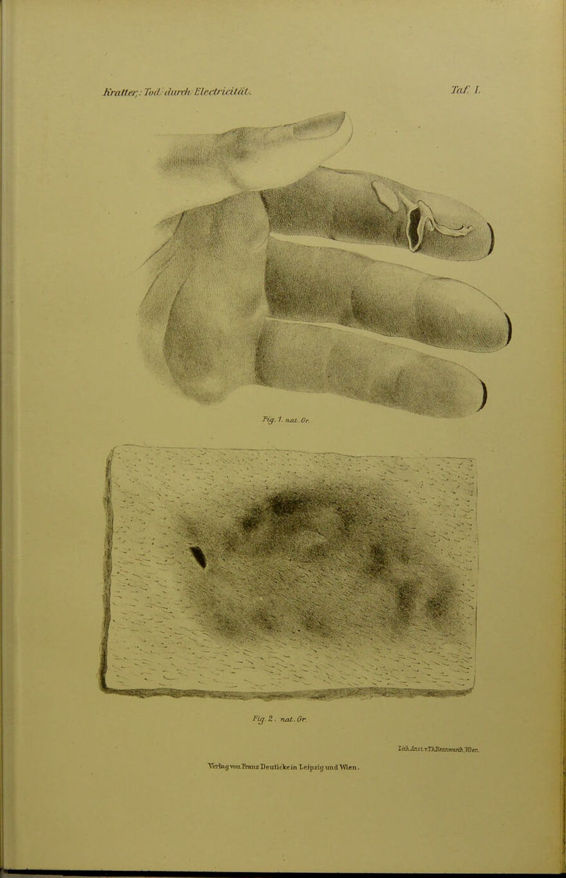 Jiratle/;: Tod ilii/rli lUcctridfät. lahJjistTrKBitttKmiAyiim. TeHag'TOn.'nanz'DeiiUdceinT.eipdgund'VnRn.