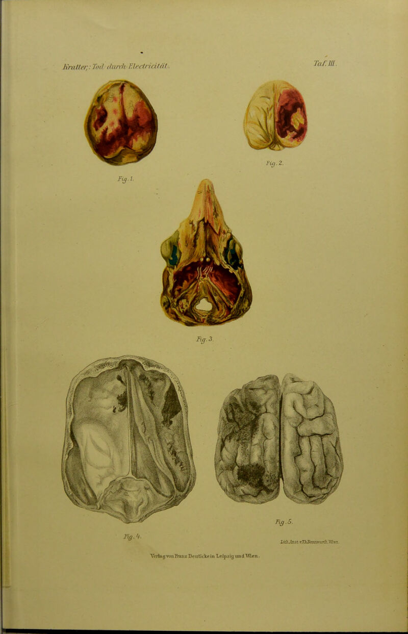 YerlHgvoiiftanz Dculicke in Lcipiij) >md Wien.