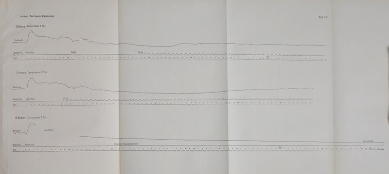 Krailer: Tod durch Elektricität. IReizung. Contactdauer 1 See.