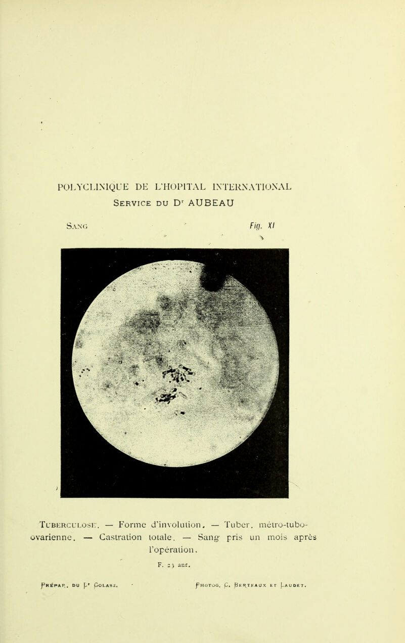 Service du D-- AUBEAU