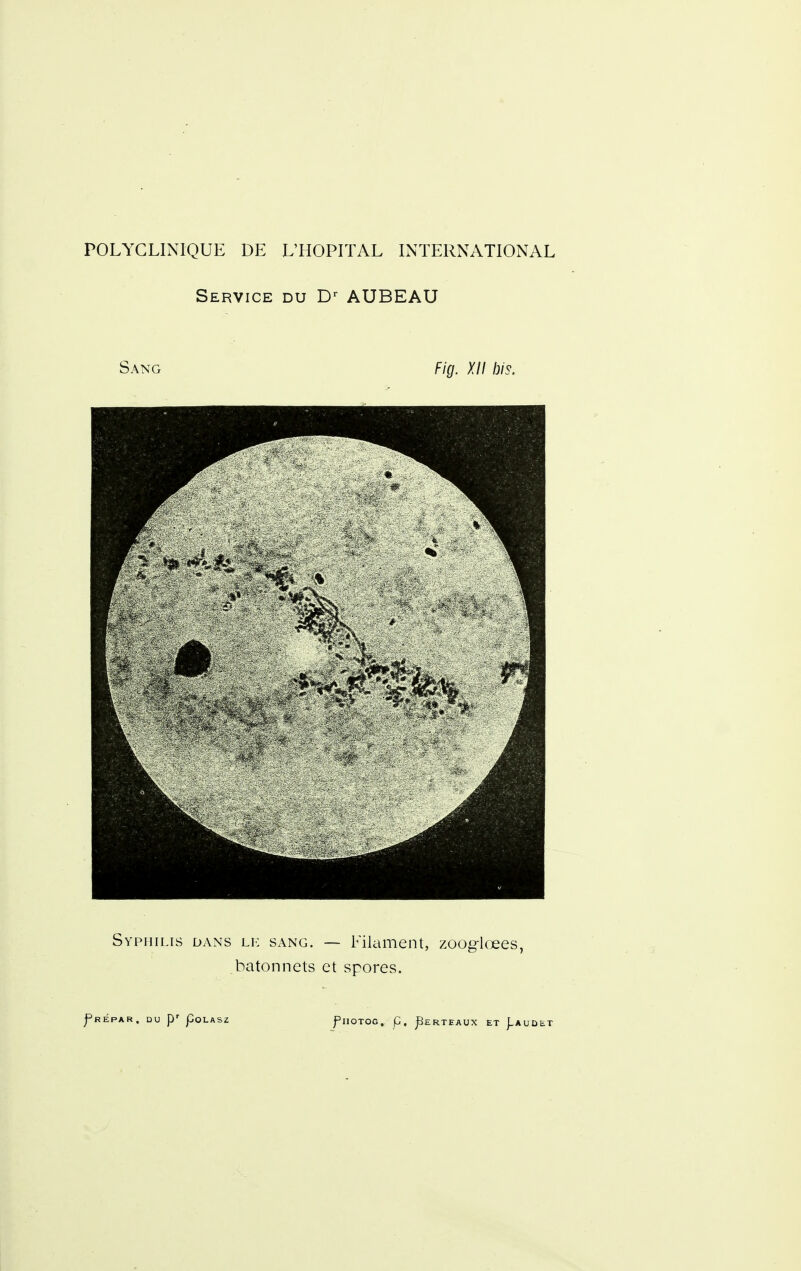 Service du D^ AUBEAU Sang Fig. XII bis. Syphilis dans lk sang. — Filament, zooglœes, bâtonnets et spores.