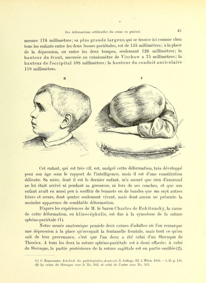 mesure 176 millimètres; sa plus grande largeur,qui se trouve ici comme chez tous les enfants entre les deux bosses pariétales, est de 135 millimètres; à la place de la dépression, ou entre les deux tempes, seulement 126 millimètres; la hauteur du front, mesurée au crâniomètre de Virchow a 75 millimètres; la hauteur de l'occipital 108 millimètres; la hauteur du conduit auriculaire 118 millimètres. H J Cet enfant, qui est très vif, est, malgré cette déformation, très développé pour son âge sous le rapport de l'intelligence, mais il est d'une constitution délicate. Sa mère, dont il est le dernier enfant, m'a assuré que rien d'anormal ne lui était arrivé ni pendant sa grossesse, ni lors de ses couches, et que son enfant avait eu aussi peu à souffrir de bonnets ou de bandes que ses sept autres frères et sœurs, dont quatre seulement vivent, mais dont aucun ne présente la moindre apparence de semblal^le déformation. D'après les expériences de M. le baron Charles de Rokitansky, la cause de cette déformation, ou klinocéphalie, est due à la synostose de la suture sphéno-pariétale (1). Notre musée anatomique possède deux crânes d'adultes où l'on remarque une dépression à la place qu'occupait la fontanelle frontale, mais tout ce qu'on sait de leur provenance, c'est que l'un deux a été celui d'un Slovaque de Thurôcz. A tous les deux la suture sphéno-pariétale est à demi effacée ; à celui du Slovaque, la partie postérieure de la suture sagittale est en partie ossifiée (2). (1) C. RoKiTANSiiY. Lelirhuch (Ter patJiologischen Anatomîe. 3. Anflage. III. t. Wien. 1856. — t. II. p. 148.