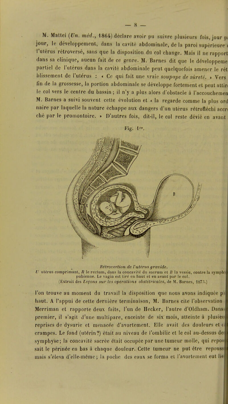 jour, le développement, dans la cavité abdominale, de la paroi supérieure < l'utérus rétroversé, sans que la disposition du col change. Mais il ne rapport dans sa clinique, aucun fait de ce genre. M. Barnes dit que le développeme partiel de l'utérus dans la cavité abdominale peut quelquefois amener le rét blissement de l'utérus : t Ce qui fait une vraie soupape de sûreté. » Vers fin de la grossesse, la portion abdominale se développe fortement et peut attin le col vers le centre du bassin ; il n'y a plus alors d'obstacle à l'accouchemen M. Barnes a suivi souvent cette évolution et « la regarde comme la plus ord naire par laquelle la nature échappe aux dangers d'un utérus rétrofléchi accr< ché par le promontoire. » D'autres fois, dit-il, le col reste dévié en avant Fig. lro. Hétrovertinn de l'utérus gravide. U utérus comprimant, R le rectum, dans la concavité du sacrum et B la vessie, contre la symphti pubienne. Le vagin est tiré en haut et en avant par le col. (Extrait des Leçons sur les opérations obstétricales, de M. Barnes, 187.î.) l'on trouve au moment du travail la disposition que nous avons indiquée pli haut. A l'appui de cette dernière terminaison, M. Barnes cite l'observation I Merriman et rapporte deux faits, l'un de Hecker, l'autre d'Oldham. Dans-I premier, il s'agit d'une multipare, enceinte de six mois, atteinte à plusiei j reprises de dysurie et menacée d'avortement. Elle avait des douleurs et (J crampes. Le fond (utérin?) était au niveau de l'ombilic et le col au-dessus deJ symphyse; la concavité sacrée était occupée par une tumeur molle, qui rcpotl sait le périnée en bas à chaque douleur. Cette tumeur ne put être repoussl mais s'éleva d'elle-même; la poche des eaux se formu et ravortemenl eut li«
