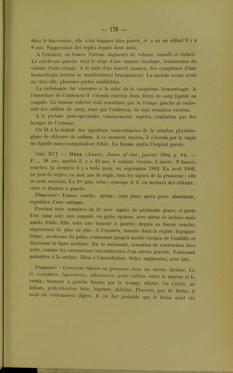 - 17Ô - dans le bas-ventre, elle s'est toujours bien portée, et a eu un enfanÉ il y a 8 ans. Suppression des règles depuis deux mois. A l'examen, on trouva l'utérus augmenté de volume, ramolli et violacé. Le cul-de-sac gauche était le siège d'une tumeur élastique, douloureuse du volume d'une orange. A la suite d'un nouvel examen, des symptômes d'une hémorrhagic interne se manifestèrent brusquement. La malade avoue avoir eu chez elle, plusieurs pertes semblables. La cœliotomie fut exécutée à la suite de la cinquième hémorrhagie. A l'ouverture de l'abdomen il s'écoula environ deux litres de sang liquide ou coagulé. La tumeur enlevée était constituée par la trompe gauche çt conte- nait des caillots de sang, ainsi que l'embryon, de sept semaines environ. A la période post-opératoire, vomissements répétés, combattus par des lavages de l'estomac. On fit à la malade des injections sous-cutanées de la solution physiolo- gique de chlorure de sodium. A ce moment encore, il s'écoula par le vagin un liquide muco-sanguinolent fétide. La femme quitta l'hôpital guérie. Obs. XCL — Meek {Americ. Journ. ofohst., janvier 1894, p. 84). — P..., 38 ans, mariée il y a 12 ans, 4 enfants vivants, 3 morts; 3 fausses couches, la dernière il y a trois mois, en septembre 1892. En avril 1893, un jour de règles; en mai, pas de règle, tous les signes de la grossesse ; elle se croit enceinte. Le 1- juin, crise ; syncope le 9, en mettant des rideaux ; crise et douleur à gauche. Diagnostic : Fausse couche, opium ; trois jours après perte abondante, expulsion d'une caduque. Pendant trois semaines au lit avec signes de péritonite grave, et perte d'un sang noir, non coagulé, en gelée épaisse, avec odeur de lochies mais amais fétide. Elle nota une tumeur à gauche, depuis sa fausse couche, augmentant de plus en plus. A l'examen, tumeur dans la région hypogas- trique, au-dessus du pubis, remontant jusqu'à moitié chemin de l'ombilic et dépassant la ligne médiane. En la saisissant, sensation de contraction bien nette, comme les contractions intermittentes d'un utérus gravide. Vaisseaux pulsatites à la surface. Rien à l'auscultation. Seins augmentés, avec lait. Diagnostic : Grossesse tubairc ou grossesse dans un utérus bicorne. Le 21 septembre, laparotomie, adhérences, petits caillots entre la tumeur et la vessie; tuumeur à gauche formée par la trompe dilatée. On l'attire au dehors, pédiculisation faite, légature, ablation. Placenta, pas de fœtus - il avait été évidemment digéré. Il est fort probable que le fœtus avait été