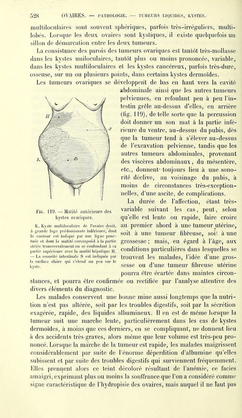 multiloculaires sont souvent sphériques, parfois très-irréguliers, niulti- lobés. Lorsque les deux ovaires sont kystiques, il existe quelquefois un sillon de démarcation entre les deux tumeurs. La consistance des parois des tumeurs ovariques est tantôt très-mollasse dans les kystes uniloculaires, tantôt plus ou moins prononcée, variable, dans les kystes multiloculaires et les kystes cancéreux, parfois très-dure, osseuse, sur un ou plusieurs points, dans certains kystes dermoïdes. Les tumeurs ovariques se développent de bas en haut vers la cavité abdominale ainsi que les autres tumeurs pelviennes, en refoulant peu à peu l'in- testin grêle au-dessus d'elles, en arrière (lig. 119), de telle sorte que la percussion doit donner un son mat à la partie infé- rieure du ventre, au-dessus du pubis, dès que la tumeur tend à s'élever au-dessus de l'excavation pelvienne, tandis que les autres tumeurs abdominales, provenant des viscères abdominaux, du mésentère, etc., donnent' toujours lieu à une sono- rité déclive, au voisinage du pubis, à moins de circonstances très-exception- nelles, d'une ascite, de complications. La durée de l'affection, étant très- variable suivant les cas, peut, selon qu'elle est lente ou rapide, faire croire au premier abord à une tumeur utérine, soit à une tumeur libl'euse, soit à une t'iG. 119. — Matitc aiiLiiricurc des kystes ovariques. K, Kysle niulliloculairc de l'ovaire droit, à grande loge prédoniiiianle inférieure, dont le contour est indique par une ligne ponc- tuée et dont la matité correspond à la partie striée transversalement en se confondant à sa partie supérieure avec la matité liépiitiquo H. — La sonorité intestinale S est indiquée par la surface claire qui s'étend un pou sur le kyste. grossesse ; mais. eu égard à l'âge, aux conditions particulières dans lesquelles se trouvent les malades, l'idée d'une gros- sesse ou d'une tumeur fibreuse utérine pourra être écartée dans maintes circon- stances, et pourra être confirmée ou rectifiée par l'analyse attentive des divers éléments du diagnostic. Les malades conservent une bonne mine aussi longtemps que la nutri- tion n'est pas altérée, soit par les troubles digestifs, soit par la sécrétion exagérée, rapide, des liquides albumineux. Il en est de même lorsque la tumeur suit une marcbe lente, particulièrement dans les cas de kystes dermoïdes, à moins que ces derniers, en se compliquant, ne donnent lieu à des accidents très-graves, alors même que leur volume est très-peu pro- noncé. Lorsque la marche de la tumeur est rapide, les malades maigrissent considérablement par suite de l'énorme déperdition d'albumine qu'elles subissent et par suite des troubles digestifs qui surviennent fréquemment. Elles prennent alors ce teint décoloré résultant de l'anémie, ce faciès amaigri, exprimant plus ou moins la souffrance que l'on a considéré comme signe caractéristique de l'hydropisie des ovaires, mais auquel il ne Tant pas
