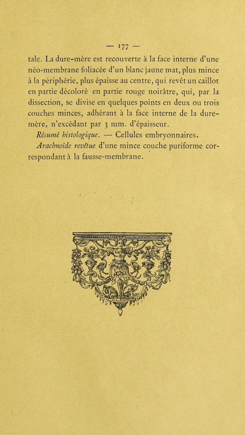 taie. La dure-mère est recouverte à la face interne d'une néo-membrane foliacée d'un blanc jaune mat, plus mince à la périphérie, plus épaisse au centre, qui revêt un caillot en partie décoloré en partie rouge noirâtre, qui, par la dissection, se divise en quelques points en deux ou trois couches minces, adhérant à la face interne de la dure- mère, n'excédant par 3 mm. d'épaisseur. Résumé histologique. — Cellules embryonnaires. Arachnoïde revêtue d'une mince couche puriforme cor- respondant.! la fausse-membrane.