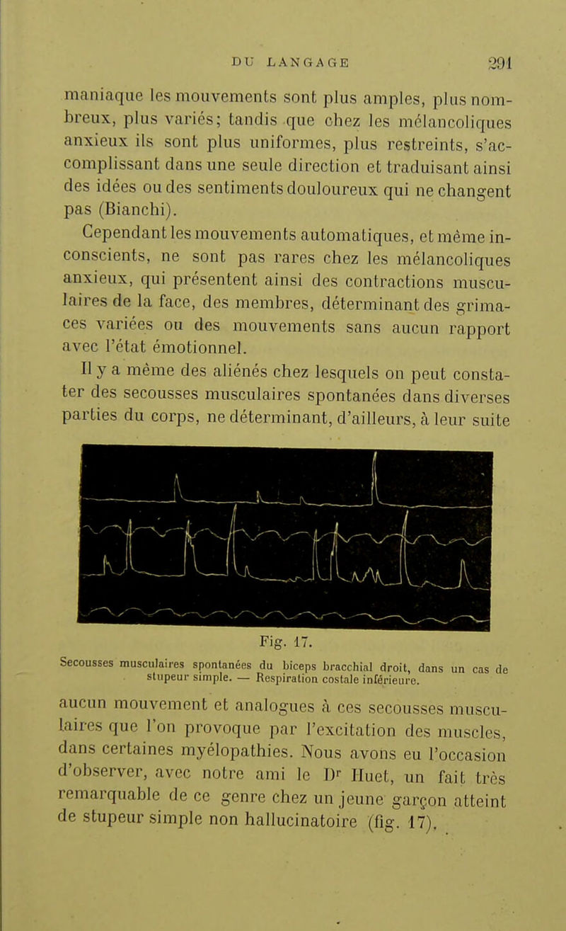 maniaque les mouvements sont plus amples, plus nom- breux, plus variés; tandis que chez les mélancoliques anxieux ils sont plus uniformes, plus restreints, s'ac- complissant dans une seule direction et traduisant ainsi des idées ou des sentiments douloureux qui ne changent pas (Blanchi). Cependant les mouvements automatiques, et même in- conscients, ne sont pas rares chez les mélancoliques anxieux, qui présentent ainsi des contractions muscu- laires de la face, des membres, déterminant des grima- ces variées ou des mouvements sans aucun rapport avec l'état émotionnel. Il y a même des aliénés chez lesquels on peut consta- ter des secousses musculaires spontanées dans diverses parties du corps, ne déterminant, d'ailleurs, cà leur suite Fig. 17. Secousses musculaires spontanées du biceps bracchial droit, dans un cas de stupeur simple. — Respiration costale inférieure. aucun mouvement et analogues cà ces secousses muscu- laires que l'on provoque par l'excitation des muscles, dans certaines myélopathies. Nous avons eu l'occasion d'observer, avec notre ami le D-- Iluet, un fait très remarquable de ce genre chez un jeune garçon atteint de stupeur simple non hallucinatoire (fig. 17).