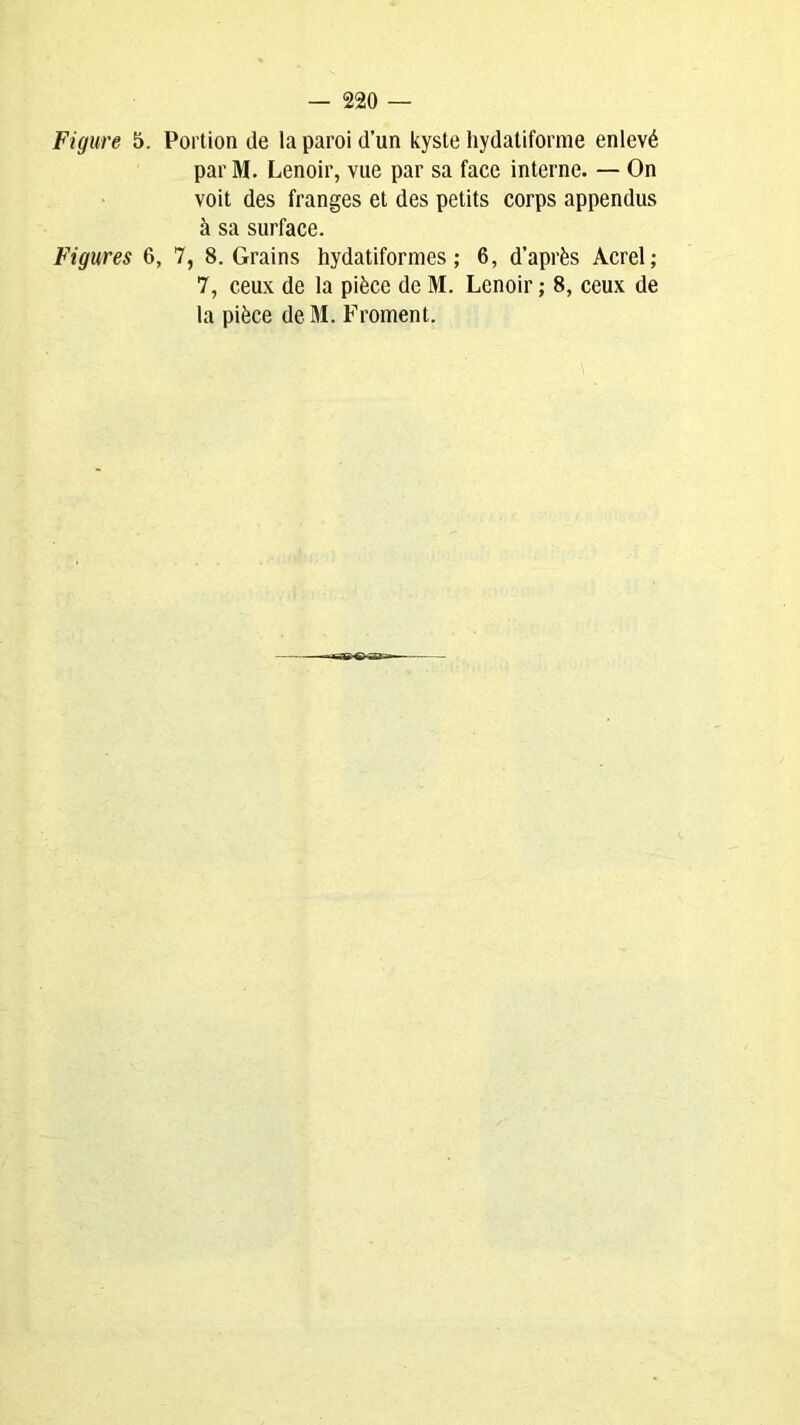 — 220 — Figure 5. Portion de la paroi d’un kyste hydatiforme enlevé par M. Lenoir, vue par sa face interne. — On voit des franges et des petits corps appendus à sa surface. Figures 6, 7, 8. Grains hydatifornies ; 6, d’après Acrel; 7, ceux de la pièce de M. Lenoir ; 8, ceux de la pièce deM. Froment.