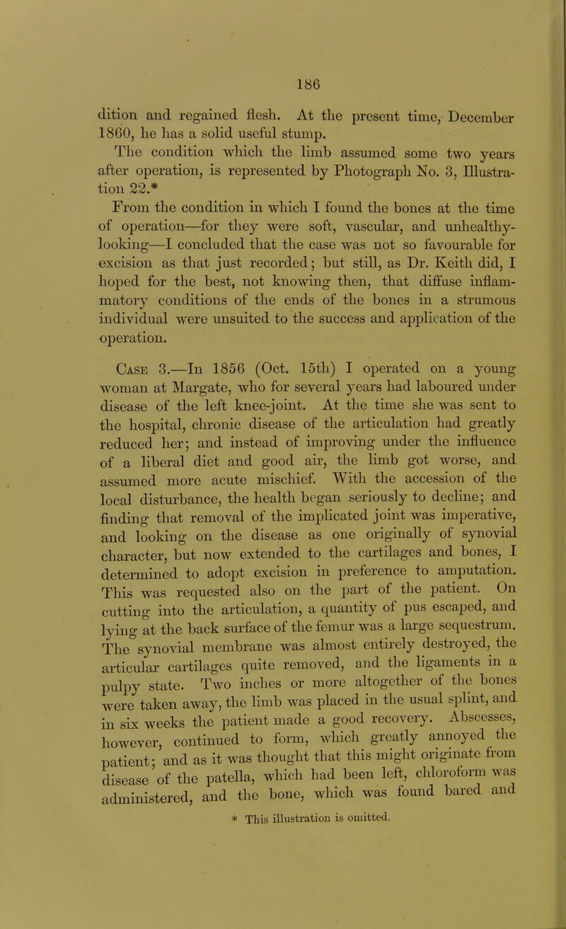 dition and regained flesh. At the present time, December 1860, he has a solid useful stump. The condition which the limb assumed some two years after operation, is represented by Photograph No. 3, Illustra- tion 22* From the condition in which I found the bones at the time of operation—for they were soft, vascular, and unhealthy- looking—I concluded that the case was not so favourable for excision as that just recorded; but still, as Dr. Keith did, I hoped for the best, not knowing then, that diffuse inflam- matory conditions of the ends of the bones in a strumous individual were unsuited to the success and application of the operation. Case 3.—In 1856 (Oct. 15th) I operated on a young woman at Margate, who for several years had laboured under disease of the left knee-joint. At the time she was sent to the hospital, chronic disease of the articulation had greatly reduced her; and instead of improving under the influence of a liberal diet and good air, the limb got worse, and assumed more acute mischief. With the accession of the local disturbance, the health began seriously to dechne; and finding that removal of the imjDlicated joint was imperative, and looking on the disease as one originally of synovial character, but now extended to the cartilages and bones, I determined to adopt excision in preference to amputation. This was requested also on the part of the patient. On cutting into the articulation, a quantity of pus escaped, and lying at the back surface of the femur was a large sequestrum. The synovial membrane was almost entirely destroyed, the articular cartilages quite removed, and the ligaments in a pulpy state. Two inches or more altogether of the bones were taken away, the limb was placed in the usual splint, and in six weeks the patient made a good recovery. Abscesses, however, continued to form, which greatly annoyed the patient; and as it was thought that this might originate from disease of the patella, which had been left, chloroform was administered, and the bone, which was found bared and * This illustration is omitted.