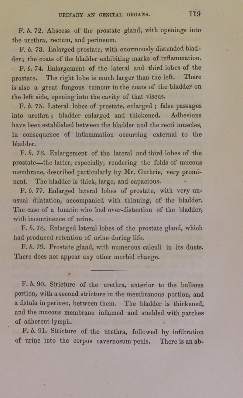 F. b. 72. Abscess of the prostate gland, with openings into the urethra, rectum, and perineum. F. b. 73. Enlarged prostate, with enormously distended blad- der ; the coats of the bladder exhibiting marks of inflammation. F. b. 74. Enlargement of the lateral and third lobes of the prostate. The right lobe is much larger than the left. There is also a great fungous tumour in the coats of the bladder on the left side, opening into the cavity of that viscus. F. b. 75. Lateral lobes of prostate, enlarged ; false passages into urethra; bladder enlarged and thickened. Adhesions have been established between the bladder and the recti muscles, in consequence of inflammation occurring external to the bladder. F. b. 76. Enlargement of the lateral and third lobes of the prostate—the latter, especially, rendering the folds of mucous membrane, described particularly by Mr. Guthrie, very promi- nent. The bladder is thick, large, and capacious. F. b. 77. Enlarged lateral lobes of prostate, with very un- usual dilatation, accompanied with thinning, of the bladder. The case of a lunatic who had over-distention of the bladder, with incontinence of urine. F. b. 78. Enlarged lateral lobes of the prostate gland, which had produced retention of urine during life. F. b. 79. Prostate gland, with numerous calculi in its ducts. There does not appear any other morbid change. F. b. 90. Stricture of the urethra, anterior to the bulbous portion, with a second stricture in the membranous portion, and a fistula in perineo, between them. The bladder is thickened, and the mucous membrane inflamed and studded with patches of adherent lymph. I, b. 91. Stricture of the urethra, followed by infiltration of urine into the corpus cavernosum penis. There is an ab-