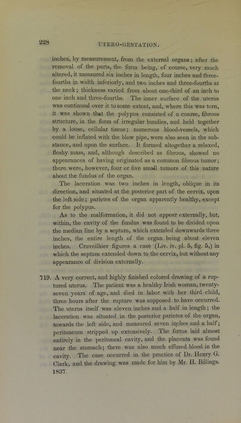UTERO-GESTATION. inches, by measurement, from the external organs; after the removal of the parts, the form being, of course, very much altered, it measured six inches in length, four inches and three- fourths ip width inferiorly, and two inches and three-fourths at the neck; thickness varied from about one-third of an inch to one inch and three-fourths. The inner surface of the uterus was continued over it to some extent, and, where this was torn, it was shown that the polypus consisted of a coarse, fibrous structure, in the form of irregular bundles, and held together by a loose, cellular tissue; numerous blood-vessels, which could be inflated with the blow pipe, were also seen in the sub- stance, and upon the surface. It formed altogether a relaxed, fleshy mass, and, although described as fibrous, showed no appearances of having originated as a common fibrous tumor; there were, however, four or five small tumors of this nature about the fundus of the organ. The laceration was two inches in length, oblique in its direction, and situated at the posterior part of the cervix, upon the left side; parietes of the organ apparently healthy, except for the polypus. As to the malformation, it did not appear externally, but, within, the cavity of the fundus was found to be divided upon the median line by a septum, which extended downwards three inches, the entire length of the organ being about eleven inches. Cruveilhier figures a case (Liv. iv. pi. 5, fig. 5,) in which the septum extended down to the cervix, but without any appearance of division externally. 719. A very correct, and highly finished colored drawing of a rup- tured uterus. The patient was a healthy Irish woman, twenty- seven years of age, and died in labor with her third child, three hours after the rupture was supposed to have occurred. The uterus itself was eleven inches and a half in length; the laceration was situated in the posterior parietes of the organ, towards the left side, and measured seven inches and a half; peritoneum stripped up extensively. The foetus laid almost entirely in the peritoneal cavity, and the placenta was found near the stomach; there was also much effused blood in the cavity. The case occurred in the practice of Dr. Henry G. Clark, and the drawing was made for him by Mr. H. Billings. 1837.