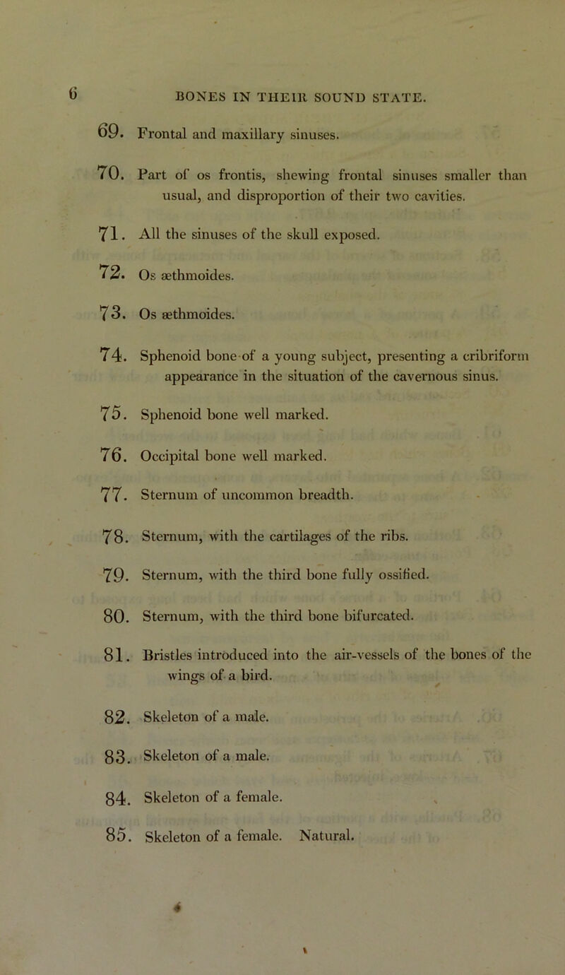 G 69. Frontal and maxillary sinuses. 70. Part of os fronds, shewing frontal sinuses smaller than usual, and disproportion of their two cavities. 71. All the sinuses of the skull exposed. 72. Os aethmoides. 73. Os aethmoides. 74. Sphenoid bone-of a young subject, presenting a cribriform appearance in the situation of the cavernous sinus. 75. Sphenoid bone well marked. 76. Occipital bone well marked. 77. Sternum of uncommon breadth. 78. Sternum, with the cartilages of the ribs. 79. Sternum, with the third bone fully ossified. 80. Sternum, with the third bone bifurcated. 81. Bristles introduced into the air-vessels of the bones of the wines of a bird. f 82. Skeleton of a male. 83. Skeleton of a male. ' . 34. Skeleton of a female. 85. Skeleton of a female. Natural. . j. % *