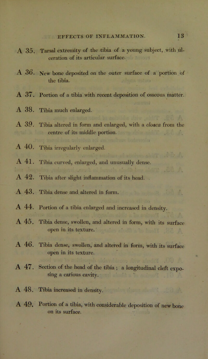 A 35. Tarsal extremity of the tibia of a young subject, .witli ul- ceration of its articular surface. t A 36. New bone deposited on the outer surface of a portion of the tibia. j A 37. A 38. A 39. A 40. A 41. A 42. A 43. A 44. A 45. A 46. A 47. Portion of a tibia with recent deposition of osseous matter. Tibia much enlarged. Tibia altered in form and enlarged, with a cloaca from the centre of its middle portion. . . Tibia irregulai’ly enlarged. Tibia curved, enlarged, and unusually dense. Tibia after slight inflammation of its head. 0 Tibia dense and altered in form. Portion of a tibia enlarged and increased in density. Tibia dense, swollen, and altered in form, with its surface open in its texture. • - • ' * Tibia dense, swollen, and altered in form, with its surface open m its texture. Section of the head of the tibia ; a longitudinal cleft expo- sing a carious cavity. • ■ - A 48. Tibia increased in density. A 49. Portion of a tibia, with considerable deposition of new bone on its surface.