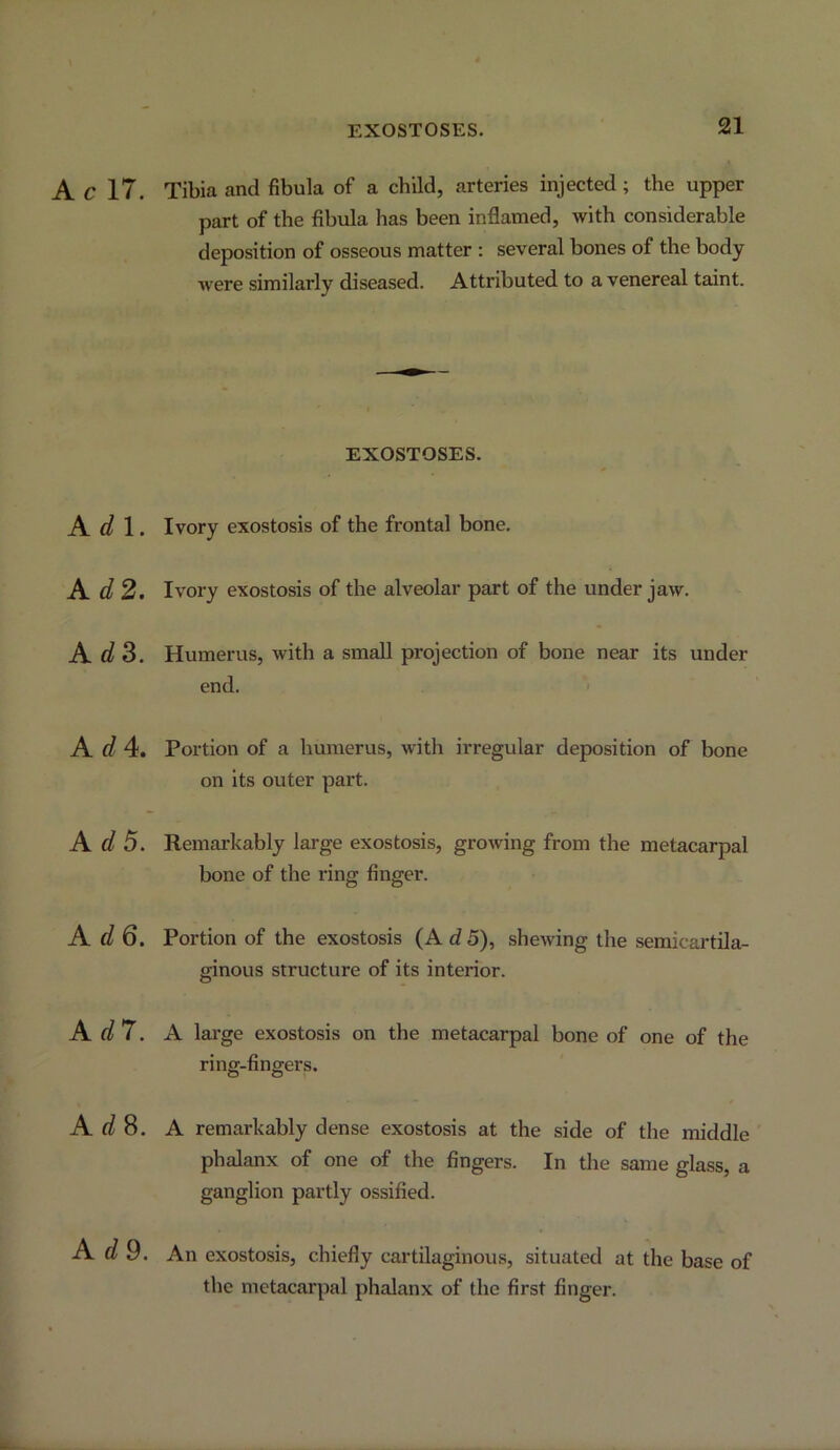 EXOSTOSES. Ac 17. Tibia and fibula of a child, arteries injected; the upper part of the fibula has been inflamed, with considerable deposition of osseous matter : several bones of the body Avere similarly diseased. Attributed to a venereal taint. EXOSTOSES. A 1. Ivory exostosis of the frontal bone. A C? 2. Ivory exostosis of the alveolar part of the under jaw. A. d S. Humerus, with a small projection of bone near its under end. ■< A t/ 4. Portion of a humerus, Avith irregular deposition of bone on its outer part. A d 5. Remarkably large exostosis, groAving from the metacarpal bone of the ring finger. Add. Portion of the exostosis (A d 5), sheAving the semicartila- ginous structure of its interior. A d7. A large exostosis on the metacarpal bone of one of the ring-fingers. At/8. A remarkably dense exostosis at the side of the middle phalanx of one of the fingers. In the same glass, a ganglion partly ossified. Add. An exostosis, chiefly cai'tilaginous, situated at the base of the metacarpal phalanx of the first finger.
