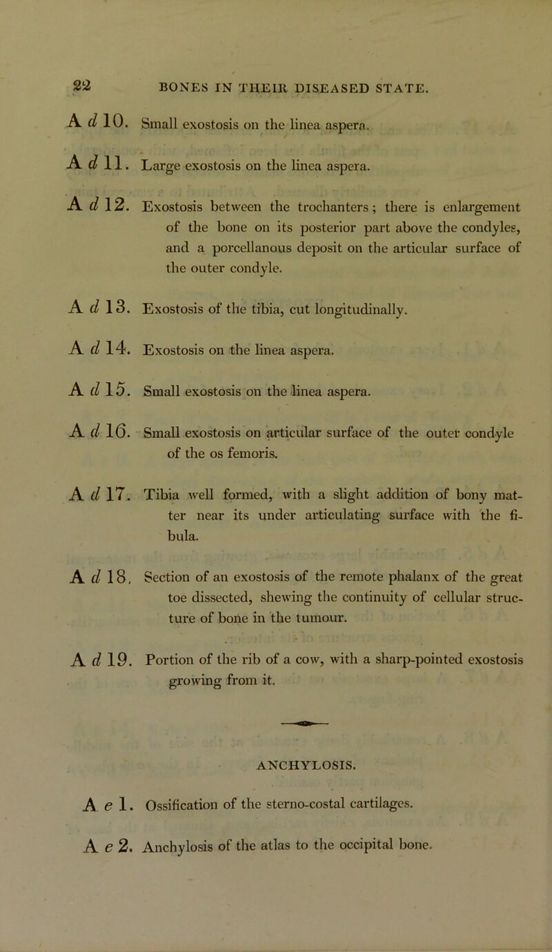 Ad 10, 11. Ad 12. Ad 13. Ad 14. Ad 15. Ad 16. Ad 17. A(/18, Ad 19. A el. Ae2. Small exostosis on the linea aspera. Large exostosis on the linea aspera. Exostosis between the trochanters; there is enlargement of the bone on its posterior part above the condyles, and a porcellanous deposit on the articular surface of the outer condyle. Exostosis of the tibia, cut longitudinally. Exostosis on the linea aspera. Small exostosis on the linea aspera. Small exostosis on articular surface of the outer condyle of the os femoris. Tibia well formed, with a slight addition of bony mat- ter near its under articulating surface with fhe fi- bula. Section of an exostosis of the remote phalanx of the great toe dissected, shewing the continuity of cellular struc- ture of bone in the tumour. Portion of the rib of a cow, with a sharp-pointed exostosis growing from it. ANCHYLOSIS. Ossification of the sterno-costal cartilages. Anchylosis of the atlas to the occipital bone.