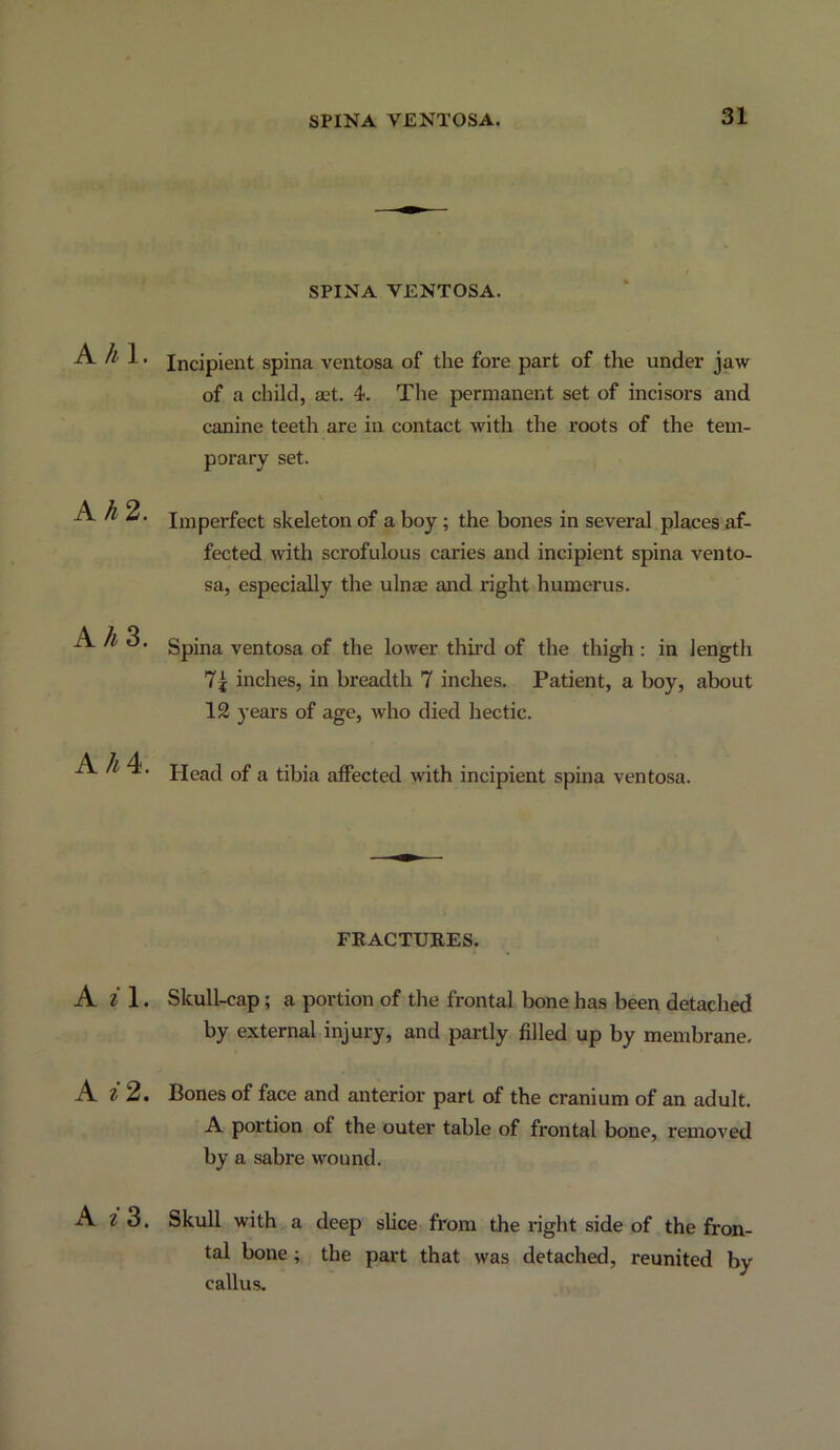 SPINA VENTOSA. A/^1. Kh2. A/^3. A/^4. A 2 1. A 2 2. x\ i 3. SPINA VENTOSA. Incipient spina ventosa of the fore part of the under jaw of a child, aet. 4. The permanent set of incisors and canine teeth are in contact with the roots of the tem- porary set. \ Imperfect skeleton of a boy; the bones in several places af- fected with scrofulous caries and incipient spina vento- sa, especially the ulnae and right humerus. Spina ventosa of the lower third of the thigh: in length 7j inches, in breadth 7 inches. Patient, a boy, about 12 years of age, who died hectic. Head of a tibia affected with incipient spina ventosa. FRACTURES. Skull-cap; a portion of the frontal bone has been detached by external injury, and partly filled up by membrane. Bones of face and anterior part of the cranium of an adult. A portion of the outer table of frontal bone, removed by a sabre wound. Skull with a deep slice from the right side of the fron- tal bone ; the part that was detached, reunited by callus.