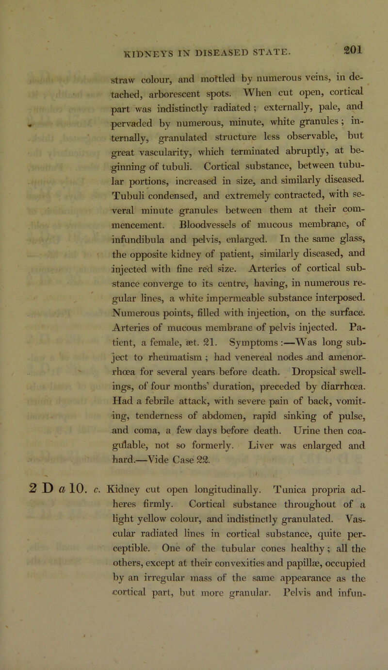 straw colour, and mottled by numerous veins, in de- tached, arborescent spots. When cut open, cortical part was indistinctly radiated ; externally, pale, and • pervaded by numerous, minute, white granules; in- ternally, gi’anulated structure less observable, but great vascularity, which terminated abruptly, at be- ginning of tubuli. Cortical substance, between tubu- lar portions, increased in size, and similarly diseased, Tubuli condensed, and extremely contracted, with se- veral minute granules between them at their com- mencement. Bloodvessels of mucous membrane, of infundibula and pelvis, enlarged. In the same glass, the opposite kidney of patient, similarly diseased, and injected with fine red size. Arteries of cortical sub- stance converge to its centre, having, in numerous re- gular lines, a white impermeable substance interposed. Numerous points, filled with injection, on the surface. Arteries of mucous membrane of pelvis injected. Pa- tient, a female, set. 21. Symptoms :—Was long sub- ject to rheumatism ; had venereal nodes and amenor- rheea for several years before death. Dropsical swell- ings, of four months’ duration, preceded by diarrhoea. Had a febrile attack, with severe pain of back, vomit- ing, tenderness of abdomen, rapid sinking of pulse, and coma, a few days before death. Urine then coa- giilable, not so formerly. Liver was enlarged and hard.—Vide Case 22. t ^ I 2 D 10. c. Kidney cut open longitudinally. Tunica propria ad- hei*es firmly. Cortical substance throughout of a light yellow colour, and indistinctly granulated. Vas- culai- radiated lines in cortical substance, quite per- ceptible. One of the tubular cones healthy; all the others, except at their convexities and papillae, occupied by an irregular mass of the same appearance as the cortical part, but more granular. Pelvis and infun-