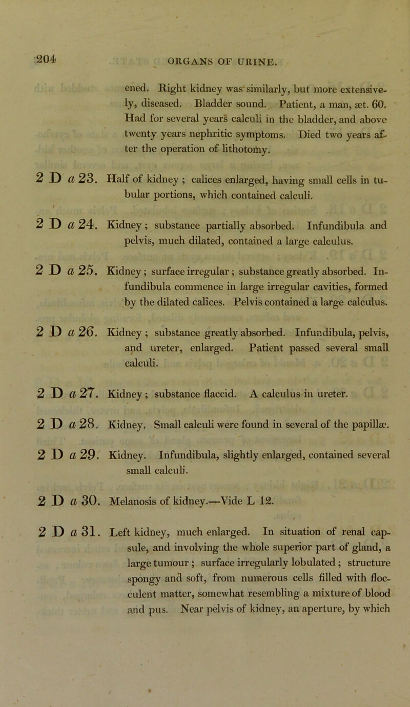 oned. night kidney was'similarly, but more extensive- ly, diseased. Bladder sound. Patient, a man, aet. 60. Had for several years calculi in the bladder, and above twenty years nephritic symptoms. Died two years af- ter the operation of lithotomy. 2 D 0/ 23. Half of kidney ; cahces enlarged, having small cells in tu- bular portions, which contained calculi. i 2 D Cl 24. Kidney ; substance partially absorbed. Infundibula and pelvis, much dilated, contained a large calculus. 2 D d 25. Kidney; surface irregular; substance greatly absorbed. In- fundibula commence in large irregular cavities, formed by the dilated calices. Pelvis contained a large calculus. 2 D Cl 26, Kidney ^ substance greatly absorbed. Infundibula, pelvis, and ureter, enlarged. Patient passed several small calculi. 2 D a 27. Kidney; substance flaccid. A calculus in ureter. 2 D Cl 28, Kidney, Small calculi were found in several of the papillae. 2D a 29. Kidney. Infundibula, slightly enlarged, contained several small calculi. 2 D Cl 30. Melanosis of kidney.—Vide L 12. 2 D a 31. Left kidney, much enlarged. In situation of renal cap- sule, and involving the whole superior part of gland, a large tumour ; surface irregularly lobulated; structure spongy and soft, from numerous cells filled with floc- culent matter, somewliat resembling a mixture of blood and pus. Near pelvis of kidney, an aperture, by wliich