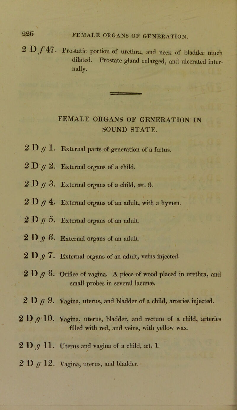 2 D/47. Prostatic portion of urethra, and neck of bladder much dilated. Prostate gland enlarged, and ulcerated inter- nally. 2D^1. 2D^2. 2D^ 3. 2 D ^ 4. 2 D ^ 5. 2D^ 6. 2 D ^ 7. 2 D ^ 8. 2 D ^ 9. 2D ^'10. 2D^ 11. 2 D ^ 12. FEMALE ORGANS OF GENERATION IN SOUND STATE. External parts of generation of a foetus. External organs of a child. External organs of a child, aet. 3. External organs of an adult, with a hymen. External organs of an adult. External organs of an adult. External organs of an adult, veins injected. Orifice of vagina. A piece of wood placed in urethra, and small probes in several lacunae. Vagina, uterus, and bladder of a child, arteries injected. Vagina, uterus, bladder, and rectum of a child, arteries filled with red, and veins, with yellow wax. Uterus and vagina of a child, aet. 1. / Vagina, uterus, and bladder.-
