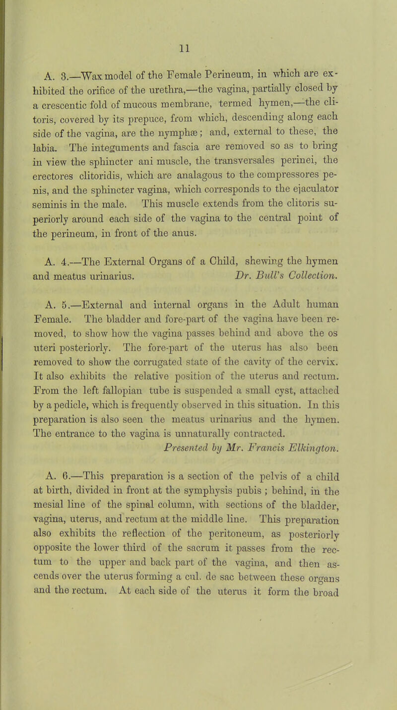 A. 3.—Wax. model of t)ie Female Perineum, in which are ex- hibited the orifice of the urethra,—the vagina, partially closed by a crescentic fold of mucous membrane, termed hymen,—the cli- toris, covered by its prepuce, from which, descending along each side of the vagina, are the nymphte; and, external to these, the labia. The integuments and fascia are removed so as to bring in view the sphincter ani muscle, the transversales perinei, the erectores clitoridis, which are analagous to the compressores pe- nis, and the sphincter vagina, which corresponds to the eiaculator seminis in the male. This muscle extends from the clitoris su- periorly around each side of the vagina to the central point of the perineum, in front of the anus. A. 4.—The External Organs of a Child, shewing the hymen and meatus urinarius. Br. Bull's Collection. A. 5.—External and internal organs in the Adult human Female. The bladder and fore-part of the vagina have been re- moved, to show how the vagina passes behind and above the os uteri posteriorly. The fore-part of the uterus has also been removed to show the corrugated state of the cavity of the cervix. It also exhibits the relative position of the uterus and rectum. From the left fallopian tube is suspended a small cyst, attached by a pedicle, which is frequently observed in this situation. In this preparation is also seen the meatus urinarius and the hymen. The entrance to the vagina is unnaturally contracted. Presented by Mr. Francis Elkington. A. 6.—This prepai'ation is a section of the pelvis of a child at birth, divided in front at the symphysis pubis ; behind, in the mesial line of the spinal column, with sections of the bladder, vagina, uterus, and rectum at the middle line. This preparation also exhibits the reflection of the peritoneum, as posteriorly opposite the lower third of the sacrum it passes from the rec- tum to the upper and back part of the vagina, and then as- cends over the uterus forming a cul. de sac between these organs and the rectum. At each side of the uterus it form the broad