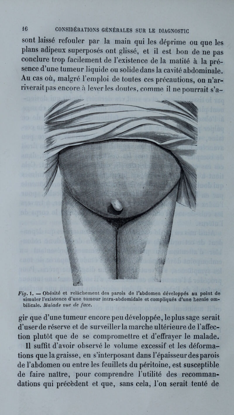 sont laissé refouler par la main qui les déprime ou que les plans adipeux superposés ont glissé, et il est bon de ne pas conclure trop facilement de l’existence de la matité à la pré- sence d’une tumeur liquide ou solide dans la cavité abdominale. Au cas où, malgré l’emploi de toutes ces précautions, on n’ar- riverait pas encore à lever les doutes, comme il ne pourrait s’a- Fig. 1. — Obésité et relâchement des parois de l’abdomen développés au point de simuler l’existence d’une tumeur intra-abdomidale et compliqués d’une hernie om- bilicale. Malade vue de face. gir que d’une tumeur encore peu développée, le plus sage serait d’user de réserve et de surveiller la marche ultérieure de l’affec- tion plutôt que de se compromettre et d’effrayer le malade. Il suffit d’avoir observé le volume excessif et les déforma- tions quelagraisse, en s’interposant dans l’épaisseur des parois de l’abdomen ou entre les feuillets du péritoine, est susceptible de faire naître, pour comprendre l’utilité des recomman- dations qui précèdent et que, sans cela, l’on serait tenté de