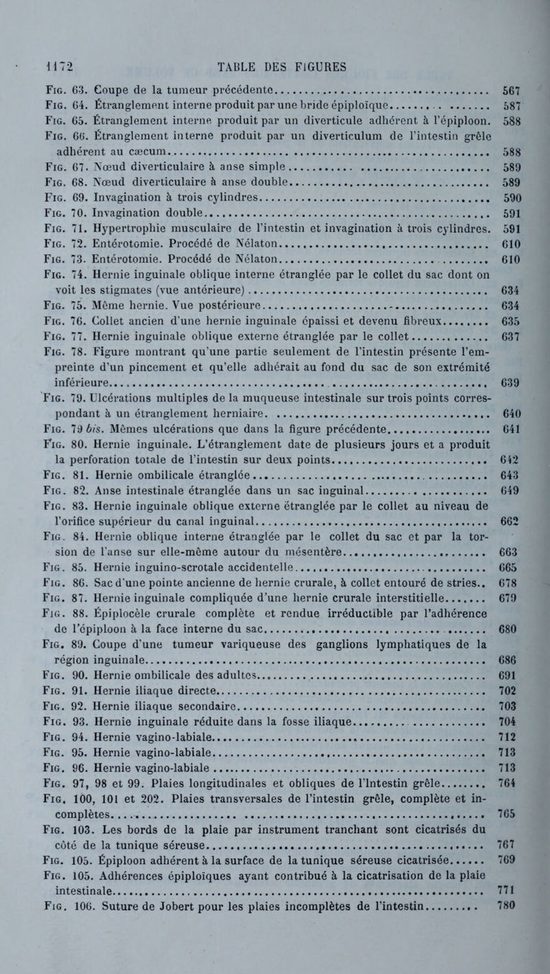 Fig. G-L Coupe de la tumeur précédente 667 Fig. G4. Étranglement interne produit par une bride épiploïque 687 Fig. G5. Étranglement interne produit par un diverticule adhérent à l’épiploon. 588 Fig. GG. Étranglement interne produit par un diverticulum de l’intestin grêle adhérent au cæcum 588 Fig. 67. Nœud diverticulaire à anse simple 589 Fig. 68. Nœud diverticulaire à anse double 589 Fig. 69. Invagination à trois cylindres 590 Fig. 70. Invagination double 691 Fig. 71. Hypertrophie musculaire de l’intestin et invagination à trois cylindres. 591 Fig. 72. Entérotomie. Procédé de Nélaton 610 Fig. 73. Entérotomie. Procédé de Nélaton 610 Fig. 74. Hernie inguinale oblique interne étranglée par le collet du sac dont on voit les stigmates (vue antérieure) 634 Fig. 75. Même hernie. Vue postérieure 634 Fig. 76. Collet ancien d'une hernie inguinale épaissi et devenu fibreux 635 Fig. 77. Hernie inguinale oblique externe étranglée par le collet 637 Fig. 78. Figure montrant qu’une partie seulement de l’intestin présente l’em- preinte d’un pincement et qu’elle adhérait au fond du sac de son extrémité inférieure 639 Fig. 79. Ulcérations multiples de la muqueuse intestinale sur trois points corres- pondant à un étranglement herniaire 640 Fig. lê bis. Mêmes ulcérations que dans la figure précédente 641 Fig. 80. Hernie inguinale. L’étranglement date de plusieurs jours et a produit la perforation totale de l’intestin sur deux points 642 Fig. 81. Hernie ombilicale étranglée 643 Fig. 82. Anse intestinale étranglée dans un sac inguinal 649 Fig. 83. Hernie inguinale oblique externe étranglée par le collet au niveau de l’orifice supérieur du canal inguinal 662 Fig. 84. Hernie oblique interne étranglée par le collet du sac et par la tor- sion de l’anse sur elle-même autour du mésentère 663 Fig. 85. Hernie inguino-scrotale accidentelle 665 Fig. 86. Sac d’une pointe ancienne de hernie crurale, à collet entouré de stries.. 678 Fig. 87. Hernie inguinale compliquée d’une hernie crurale interstitielle 679 Fig. 88. Épiplocèle crurale complète et rendue irréductible par l’adhérence de l’épiploon à la face interne du sac 680 Fig. 89. Coupe d’une tumeur variqueuse des ganglions lymphatiques de la région inguinale 686 Fig. 90. Hernie ombilicale des adultes 691 Fig. 91. Hernie iliaque directe 702 Fig. 92. Hernie iliaque secondaire 703 Fig. 93. Hernie inguinale réduite dans la fosse iliaque 704 Fig. 94. Hernie vagino-labiale 712 Fig. 95. Hernie vagino-labiale 713 Fig. 96. Hernie vagino-labiale 713 Fig. 97, 98 et 99. Plaies longitudinales et obliques de l’Intestin grêle 764 Fig. 100, 101 et 202. Plaies transversales de l’intestin grêle, complète et in- complètes. 765 Fig. 103. Les bords de la plaie par instrument tranchant sont cicatrisés du côté de la tunique séreuse 767 Fig. 105. Épiploon adhérent à la surface de la tunique séreuse cicatrisée 769 Fig. 105. Adhérences épiploïques ayant contribué à la cicatrisation de la plaie intestinale 771 Fig. 106. Suture de Jobert pour les plaies incomplètes de l’intestin 780