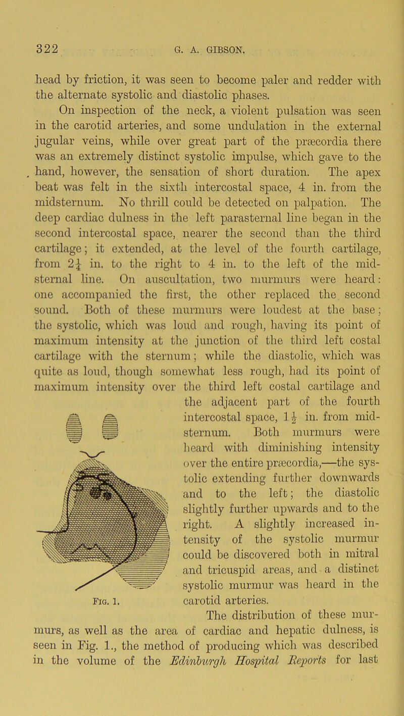 head by friction, it was seen to become paler and redder with the alternate systolic and diastobc phases. On inspection of the neck, a violent pulsation was seen in the carotid arteries, and some undulation in the external jugular veins, while over great part of the prsecordia there was an extremely distinct systolic impulse, which gave to the . hand, however, the sensation of short duration. The apex beat was felt in the sixth intereostal space, 4 in. from the midsternum. No thrill could be detected on palpation. The deep cardiac dulness hi the left parasternal line began in the second intercostal space, nearer the second than the third cartilage; it extended, at the level of the fourth cartilage, from 21 in. to the riglit to 4 in. to the left of the mid- sternal line. On auscultation, two murmurs were heard: one accompanied the first, the other replaced the, second sound. Both of these murmurs were loudest at the base; the systolic, which was loud and rougli, having its point of maximum intensity at the junction of the third left costal cartilage with the sternum; while the diastolic, which was quite as loud, tliough somewhat less rough, had its point of maximum intensity over the third left costal cartilage and tlie adjacent part of the fourth intercostal space, 1 J in. from mid- sternum. Both murmurs were lieard with diminisliing intensity over the entire pnecordia,—the sys- tolic extending furtlier downwards and to the left; the diastolic slightly further upwards and to the right. A slightly increased in- tensity of the systolic murmur could be discovered both in mitral and tricuspid areas, and a distinct systohc murmur was heard in the Fiq. 1. carotid arteries. The distribution of these mur- murs, as well as the area of cardiac and hepatic dulness, is seen in Fig. 1., the method of producing whicli was described in the volume of the Edinhii.rgli Hospital Reports for last