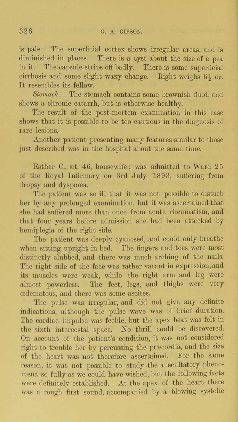 is pale. The superficial cortex shows irregular areas, and is diminished in places. There is a cyst about the size of a pea hi it. The capsule strips off badly. There is some superficial cirrhosis and some slight waxy change. Eight weighs 6^ oz. It resembles its fellow. Stomach.—The stomach contams some brownish fluid, and shows a chronic catarrh, but is otherwise healthy. The result of the post-mortem examination in this case shows that it is possible to be too cautious in the diagnosis of rare lesions. Another patient presenting many features similar to those just described was in the hospital about the same time. Esther C., 03t. 46, housewife; was admitted to Ward 25 of the Eoyal Infirmary on 3rd July 1893, suffering from dropsy and dyspnoea. The patient was so ill that it was not possible to disturb her by any prolonged examination, but it was ascertained that she had suffered more than once from acute rheumatism, and tliat four years before admission she had been attacked by liemi])legia of the right side. The patient was deeply cyanosed, and could only breathe wlien sitting upright in bed. The fingers and toes were most distinctly clubbed, and there was much arching of the nails. The right side of the face was rather vacant in expression, and its muscles were weak, while the right arm and leg were almost powerless. The feet, legs, and thighs were very oedematous, and there was some ascites. The pulse was irregular, and did not give any definite indications, altliough the pulse wave was of brief duration. The cardiac impulse was feeble, but the apex beat was felt in the sixth intercostal space. No thrill could be discovered. On account of the patient’s condition, it was not considered right to trouble her by percussing the prtecordia, and the size of the heart was not therefore ascertamed. For the same reason, it was not possible to study the auscultatory pheno- mena so fully as we could have wished, but the following facts were definitely established. At the apex of the heart there was a rough first sound, accompanied by a blowing systolic