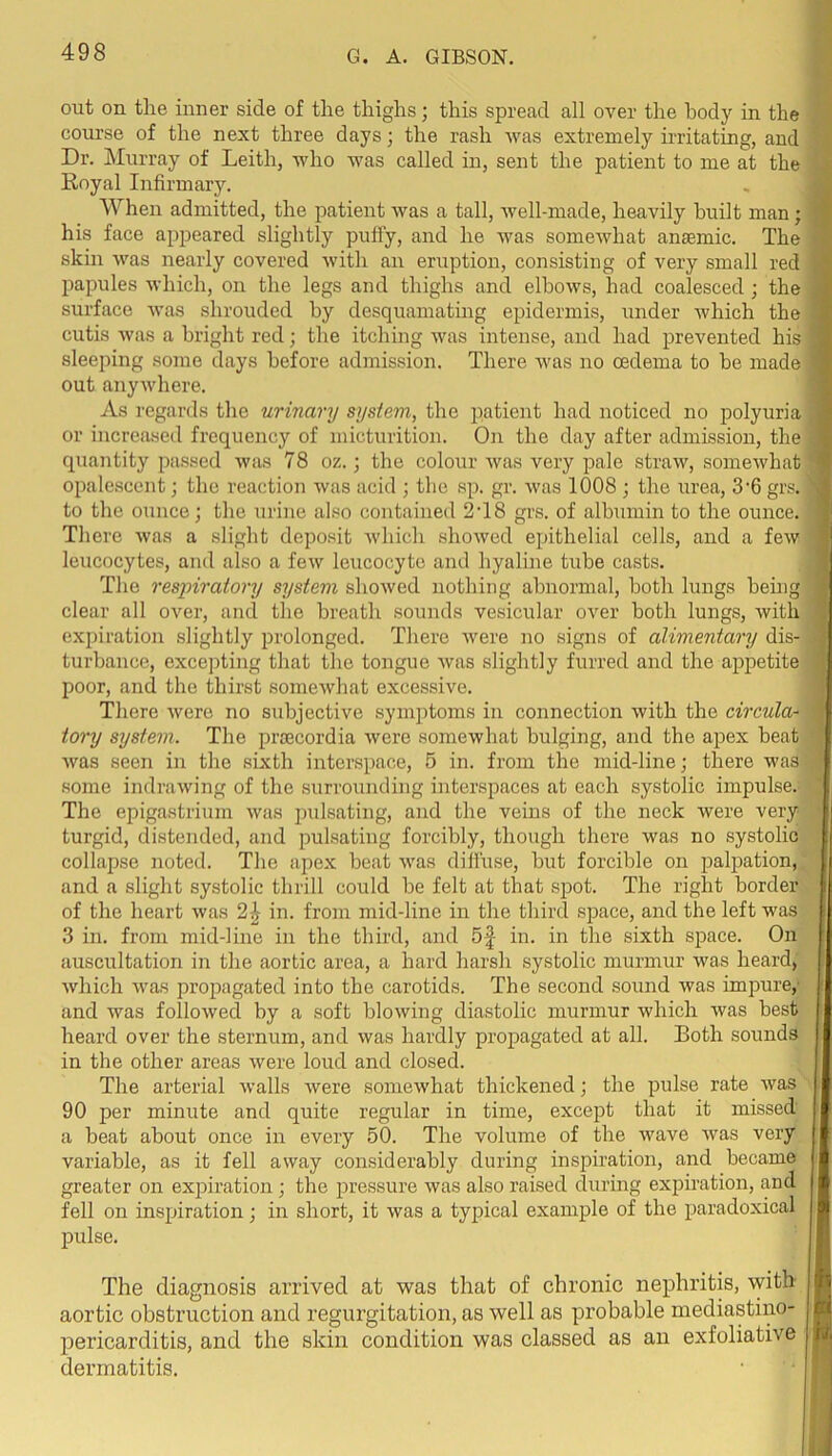 out on tlie inner side of the thighs; this spread all over the body in the i course of the next three days; the rash was extremely irritating, and Dr. Murray of Leith, who was called in, sent the patient to me at the Royal Infirmary. When admitted, the patient was a tall, well-made, heavily built man; i his face appeared slightly puffy, and he was someAvhat anaemic. The skin was nearly covered with an eruption, consisting of very small red y papules which, on the legs and thighs and elbows, had coalesced ; the , surface was shrouded by desquamating epidermis, under which the ' cutis was a bright red; the itching was intense, and had prevented his , sleeping some days before admission. There Avas no oedema to be made ’ out anyAvhere. As regards the urinary system, the patient had noticed no polyuria or increased frequency of micturition. On the day after admission, the quantity passed was 78 oz.; the colour was very pale straw, somewhat opalescent; the reaction was acid ; the sp. gr. Avas 1008 ; the urea, 3'6 grs. to the ounce; the urine also contained 2T8 grs. of albumin to the ounce. There Avas a slight deposit Avhich shoAved epithelial cells, and a feAV leucocytes, and also a feAV leucocyte and hyaline tube casts. ! The respiratory system shoAved nothing abnormal, both lungs being : clear all OAmr, and the breath sounds vesicular over both lungs, Avith expiration slightly prolonged. There Avere no signs of alimentary dis- turbance, excepting that the tongue Avas slightly furred and the airpetite poor, and the thirst someAvhat excessive. There Avere no subjective symptoms in connection Avith the circular ) tory system. The proecordia Avere somewhat bulging, and the apex beat Avas seen in the sixth interspace, 5 in. from the mid-line; there was some indraAving of the surrounding interspaces at each systolic impulse.- The epigastrium Avas pidsating, and the veins of the neck were very turgid, distended, and pulsating forcibly, though there was no systolic collapse noted. The apex beat Avas diffuse, but forcible on palpation, and a slight systolic thrill could be felt at that spot. The right border of the heart Avas 2^ in. from mid-line in the third space, and the left was 3 in. from mid-line in the third, and 5| in. in the sixth space. On auscultation in the aortic area, a hard harsh systolic murmur Avas heardj ' Avhich Avas propagated into the carotids. The second sound Avas impure/ ; and was folloAved by a soft bloAving diastolic murmur which Avas best heard over the sternum, and was hardly propagated at all. Both sounds in the other areas Avere loud and closed. The arterial Avails Avere someAvhat thickened; the pulse rate Avas 90 per minute and quite regular in time, except that it missed a beat about once in every 50. The volume of the Avave Avas very variable, as it fell away considerably during inspiration, and became greater on expiration; the pressure Avas also raised during expiration, and fell on inspiration; in short, it Avas a typical example of the paradoxical pulse. The diagnosis arrived at was that of chronic nephritis, Avith aortic obstruction and regurgitation, as well as probable mediastino- pericarditis, and the skin condition was classed as an exfoliative dermatitis.