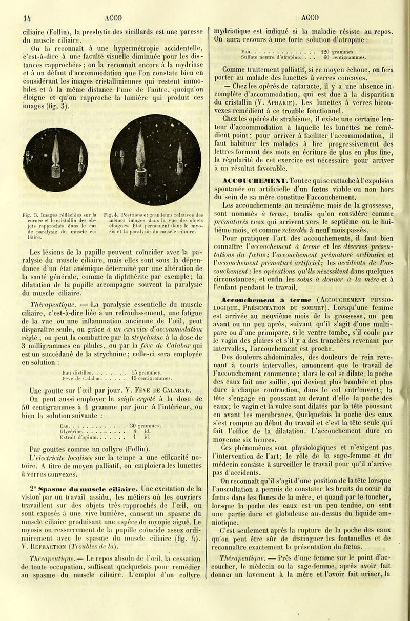 ciliaire (Follin), la presbytie des vieillards est une paresse du muscle ciliaire. On la reconnaît à une hypermétropie accidentelle, c'est-à-dire à une faculté visuelle diminuée pour les dis- tances rapprochées; on la reconnaît encore à la mydriase et à un défaut d'accommodation que l'on constate bien en considérant les images cristalliniennes qui restent immo- biles et à la même distance l'une de l'autre, quoiqu'on éloigne et qu'on rapproche la lumière qui produit ces images (fig. 3). Fig. 3. Images réfléchies sur la Fig. 4. Positions et gi anJeurs relatives des cornée et le cristallin des ob- mêmes images dans la vue dos objets jets rapprochés dans le cas éloignés. État permanent dans le myo- de paralysie du muscle ci- sis et la paralysie du muscle ciliaire. littire. Les lésions de la papille peuvent coïncider avec la pa- ralysie du muscle ciliaire, mais elles sont sous la dépen- dance d'un état anémique déterminé par une altération de la santé générale, comme la diphtliéritc par exemple ; la dilatation de la pupille accompagne souvent la paralysie du muscle ciliaire. Thérapeutique. — La paralysie essentielle du muscle ciliaire, c'est-à-dire liée à un refroidissement, une fatigue de la vue ou une inflammation ancienne de l'œil, peut disparaître seule, ou grâce à un exercice if accommodation réglé ; on peut la combattre par la strychnine à la dose de 3 milligrammes en pilules, ou par la fève de Calabar qui est un succédané de la strychnine ; celle-ci sera employée en solution : Eau distillée 15 grammes. Fève de C.alahar 15 centigrammes. Une goutte sur l'œil par jour. V. Fève de Calabar. On peut aussi employer le seigle ergoté à la dose de 50 centigrammes à 1 gramme par jour à l'intérieur, ou bien la solution suivante : Eau 30 grammes. Glycérine i id. Extrait d'opium 1 id. Par gouttes comme un collyre (Follin). L'électricité localisée sur la tempe a une efficacité no- toire. A titre de moyen palliatif, on emploiera les lunettes à verres convexes. 2° Spasme du muscle ciliaire. Une excitation de la vision* par un travail assidu, les métiers où les ouvriers travaillent sur des objets trè.s-rapprochés de l'œil, ou sont exposés à une vive lumière, causent un spasme du muscle ciliaire produisant une espèce de myopie aiguë. Le myosis ou resserrement de la pupille coïncide assez ordi- nairement avec le spasme du muscle ciliaire (fig. h). V. RÉFRACTION {Troubles de la). Thrrapi'iitiquc.— Le repos absolu de I'omI, la cossalion de toute occupation, suffisent quelquefois poiu' remédier au spasme du muscle ciliaire. L'emploi d'un collyre mydriatique est indiqué si la maladie résiste au repos. On aura recours à une forte solution d'atropine : Eau 120 grammes. Sulfate neutre d'atropine. ... GO centigramnies. Comme traitement palliatif, si ce moyen échoue, on fera porter au malade des lunettes à verres concaves. — Chez les opérés de cataracte, il y a une absence in- complète d'accommodation, qui est due à la disparition du cristallin (V. Aphakie). Les lunettes à verres bicon- vexes remédient à ce trouble fonctionnel. Chez les opérés de strabisme, il existe une certaine len- teur d'accommodation à laquelle les lunettes ne remé- dient point ; pour arriver à faciliter l'accommodation, il faut habituer les malades à lire progressivement des lettres formant des mots en écriture de plus en plus fine, la régularité de cet exercice est nécessaire pour arriver à un résultat favorable. ACtorC'ilEMElMT. Tout ce qui se rattache à l'expulsion spontanée ou artificielle d'un fœtus viable ou non hors du sein de sa mère constitue l'accouchement. Les accouchements au neuvième mois de la grossesse, sont nommés « terme, tandis qu'on considère comme prématurés ceux qui arrivent vers le septième ou le hui- tième mois, et comme retardés à neuf mois passés. Pour pratiquer l'art des accouchements, il faut bien connaître Vaccouchement à terme et les diverses présen- tations du fœtus ; Y accouchement prématuré ordinaire et Y accouchement prématuré artificiel ; \es accidents de l'ac- couchement; les opérations qu'ils nécessitent dans quelques circonstances, et enfin les soins à donner à la mère et à l'enfant pendant le travail. Accouchement à terme (ACCOUCHEMENT PHYSIO- LOGIQUE, Présentation du sommet). Lorsqu'une femme est arrivée au neuvième mois de la grossesse, un peu avant ou un peu après, suivant qu'il s'agit d'une multi- pare ou d'une primipare, si le ventre tombe, s'il coule par le vagin des glaires et s'il y a des tranchées revenant par intervalles, l'accouchement est proche. Des douleurs abdominales, des douleurs de rein reve- nant à courts intervalles, annoncent que le travail de l'accouchement commence; alors le col se dilate, la poche des eaux fait une saillie, qui devient plus bombée et plus dure à chaque contraction, dans le col entr'ouvei't; la tête s'engage en poussant au devant d'elle la poche des eaux ; le vagin et la vulve sont dilatés par la tête poussant en avant les membranes. Quelquefois la poche des eaux s'est rompue au début du travail et c'est la tête seule qui fait l'office de la dilatation. L'accouchement dure en moyenne six heures. Ces phénomènes sont physiologiques et n'exigent pas l'intervention de l'art; le rôle de la sage-femme et du médecin consiste à surveiller le travail pour qu'il n'arrive pas d'accidents. On reconnaît qu'il s'agit d'une position de la tête lorsque l'auscultation a permis de constater les bruits du cœur du fœtus dans les flancs de la mère, et quand par le toucher, lorsque la poche des eaux est un peu tendue, on sent une partie dure et globuleuse au-dessus du liquide am- niotique. C'est seulement après la rupture de la poche des eaux qu'on peut être sûr de distinguer les fontaTielles et de reconnaître exactement la présentation du fœtus. Thérapeutique. — Près d'une femme sur le point d'ac- couchei', 1(! médecin ou la sage-femme, après avoir fait donner un lavement à la mère et l'avoir fait uriner, la