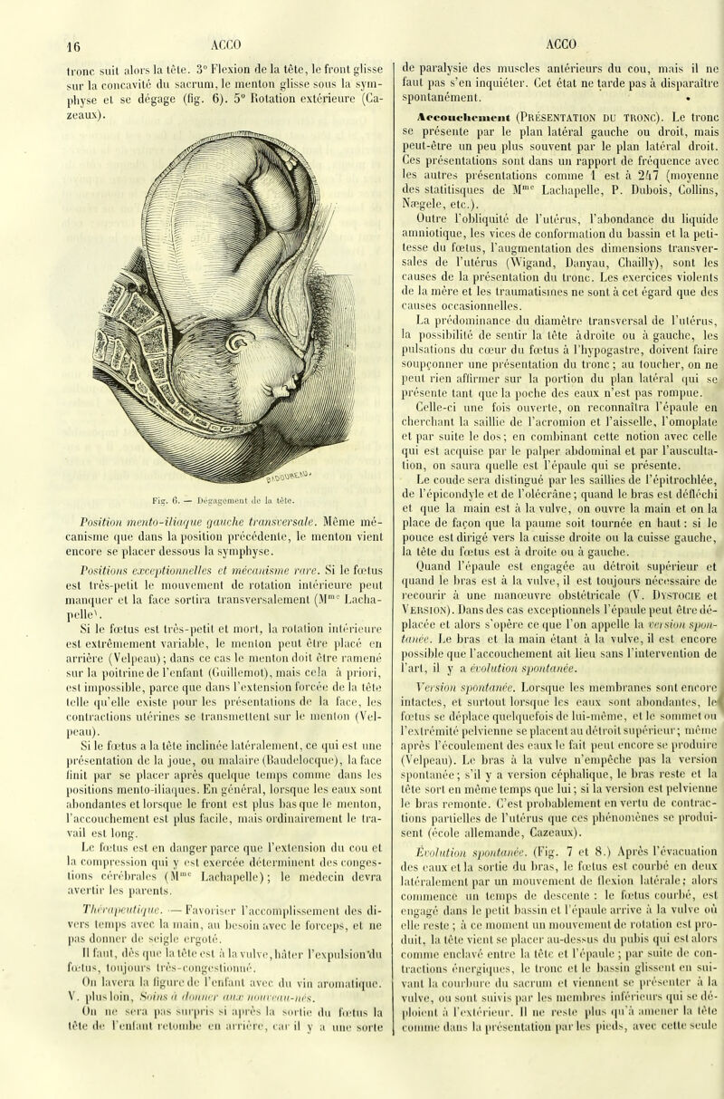 tronc suit alors la tète. 3° Flexion de la tête, le front glisse sur la concavité du sacrunnje menton glisse sous la sym- physe et se dégage (fig. 6). 5 Rotation extérieure (Ca- zeaux). Fig. 6. — Dégagonient ilo la tùle. Position mento-iliaque gauche transversale. Même mé- canisme que dans la position précédente, le menton vienl encore se placer dessous la symphyse. Positions exceptionnelles et mécanisme rare. Si le fœtus est très-pelit le mouvement de rotation inléi ieurc peut mamiuer et la face sortira transversalemenl (M''' Laclia- pelle^ Si le fœtus est très-petit et mort, la rotation intérieure esl extrêmement variable, le menton peut être placé en arrière (Velpeau) ; dans ce cas le menton doit être ramené sur la poitrine de Fcnfant (Guillemot), mais cela à priori, est hnpossible, parce que dans l'extension forcée de la tête telle qu'elle existe pour les présentations de la face, les contractions utérines se transmettent sur le nienlon (Vel- peau). Si le fœtus a la tète inclinée latéralement, ce qui est une présentation de la joue, ou nudaire (lîaudelocque), la face linit i)ar se placer après quelque temps comme dans les positions mento-iliaques. En général, lorsque les eaux sont abondantes et lorsque le front est plus basque le menton, l'accouchement est plus facile, mais ordinairement le tra- vail est long. Le fœtus est en danger parce que l'extension du cou et la compression qui y est exercée déterminent des conges- tions cérébrales (M''= Lachapelle) ; le médecin devivi avertir les parents. Tlicraiieutii/ue. —Favoriser raccomplissement des di- vers temjis avec la main, au besoin avec le forceps, et ne pas donner d(! seigle ergoté. Il faut, dès que la tète est à la vulve, liàler l'expulsion'du fcetus, toujours très-congestiunué. On lavera la figure de l'enfant avec du vin aromati(pie. V. plus loin, Soins à doiinrr an.r nuiivrou-nés. On ne sera pas sMr|iris si après la sortie du firtus la tète de reniant relumlie eu arrière, car il v a une sorte de paralysie des muscles antérieurs du cou, mais il ne faut pas s'en inquiéter. Cet état ne tarde pas à disparaître spontanément. Aocouclieinent (PRÉSENTATION DU TRONC). Le tronc se présente par le plan latéral gauche ou droit, mais peut-être un peu plus souvent par le plan latéral droit. Ces présentations sont dans un rapport de fréquence avec les autres présentations comme 1 est à 2hl (moyenne des statitisques de M Lachapelle, P. Dubois, Collins, Naîgele, etc.). Outre l'obliquité de l'utérus, l'abondance du liquide amniotique, les vices de conformation du bassin et la peti- tesse du fœtus, l'augmentation des dimensions transver- sales de l'utérus (Wigand, Danyau, Chailly), sont les causes de la présentation du tronc. Les exercices violents de la mère et les traumatismes ne sont à cet égard que des causes occasionnelles. La prédominance du diamètre transversal de l'utérus, la possibilité de sentir la tète adroite ou à gauche, les pulsations du cœur du fœtus à l'hypogastre, doivent faire soupçonner une présentation du tronc ; au toucher, on ne peut rien afluaiier sur la portion du plan latéral qui se présente tant que la poche des eaux n'est pas rompue. Celle-ci une fois ouverte, on reconnaîtra l'épaule en cherchant la saillie de l'acromion et l'aisselle, l'omoplate et par suite le dos; en combinant cette notion avec celle qui est acquise par le palper abdominal et par l'ausculta- tion, on saura quelle est l'épaule qui se présente. Le coude sera distingué parles saillies de l'épitrochlée, de l'épicondyle et de l'olécràne ; quand le bras est défléchi et que la main est à la vulve, on ouvre la main et on la place de façon que la paume soit tournée en haut : si le pouce est dirigé vers la cuisse droite ou la cuisse gauche, la tête du fœtus est à droite ou à gauche. Quand l'épaule est engagée au détroit supérieur et quand le bras est à la vulve, il est toujoui's néciîssaire de lecourir à une manœuvre obstétricale (V. Dvstocie et Version). Dans des cas exceptionnels l'épaule peut être dé- placée et alors s'opère ce que l'on appelle la vei sion. spon- tanée. Le bras et la main étant à la vulve, il est encore possible que l'accouchement ait lieu sans l'intervention de l'art, il y a évolution sponta/iée. Version spontanée. Lorsque les membranes sont encore intactes, et surtout lors(|ue les eaux sont ahondanti's, le hetus se déplace quelquefois de lui-même, et le soiumel ou l'extrémité pelvienne se placent au détroit supérieur; nu'me après l'écoulement des eaux le fait iieul encore se produire (Velpeau). Le bras à la vulve n'empêche pas la version spontanée; s'il y a version céplialique, le bras reste et la tête sort en môme temps que lui ; si la version est pelvienne le bras remonte. C'est probablement en vertu de contrac- tions partielles de l'utérus que ces phénoniènes se produi- sent (école allemande, Cazeaux). Évolution spontanée. (Fig. 7 et S.) Après l'évacuation des eaux et la sortie du bras, le fietus est courbé en deux latéralement par un mouvement de flexion latérale; alors coiiunence uii temps de descente : le fcelus courbé, est engagé dans le petit bassin et l'épaule arrive à la vulve où elle reste ; à ce moment un mouvement de rotation est pro- duit, la tête vienl se placer au-des^us du jinhis qui est alors comme enclavé entre la tête et l'épaule ; par suite de con- tractions énergiques, le tronc et le bassin glissent en sui- vant la (;ourbuie du sacrum et viennent se présenter à la vulve, ou sont suivis par les membres inférieurs qui se dé- pldienl à l'extérieur. Il ne reste plus ipi'à amener la lêle comme dans la présentation parles pieds, avec celle seule