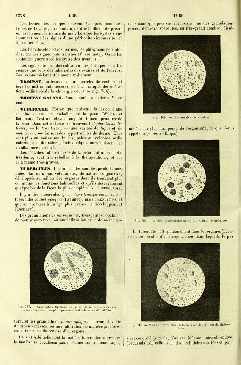 Les kystes des trompes peuvent être pris pour des kystes de l'ovaire, au début, mais il est difficile de préci- ser exactement la nature du mal. Lorsque les kystes s'en- flamment on a les signes d'une péritonite circonscrite, et rien autre chose. Les hématocèles rétro-utérines, les phlegmons péri-uté- rins, ont des signes plus tranchés (V. ces mots). On ne les confondra guère avec les kystes des trompes. Les signes de la tuberculisation des trompes sont les mêmes que ceux des tubercules des ovaires et de l'utérus. Ces lésions réclament le même traitement. TKOVîiSE. La trousse est un portefeuille renfermant tous les instruments nécessaires à la pratique des opéra- tions ordinaires de la chirurgie courante (fig. 706). TROUSSE-GAL.^NT. Nom donné au choléra. V. ce mol. TLRERCIJLE. Forme que présente la lésion d'une certaine classe des maladies de la peau (Willau et Baleman). C'est une élevure ou petite tumeur primitive de la peau. Dans cette classe se trouvent Véléphantiasis des Grecs, ■— le frambœsia, — ime variété de lupus et de moUuscum. — Ce sont des hypertrophies du derme. Elles sont plus ou moins multipliées, pâles ou colorées, ordi- nairement stationnaires, mais quelques-unes finissent par s'enflammer et s'ulcérer. Les maladies tuberculeuses de la peau ont une.marche très-lente, sont très-rebelles à la thérapeutique, et par cela même très-graves. TUBERCULEl^. Les tubercules sont des produits mor- bides plus ou moins volumineux, de nature conjonctive, développés au milieu des organes dont ils troublent plus ou moins les fonctions habituelles et qu'ils désorganisent quelquefois de la façon la plus complète. V. Tuberculose. 11 y a des tubercules gris, demi-transparents, et des tubercules7««;ies opaques (Laennec), mais ceux-ci ne sont que les premiers à un âge plus avancé de développement (Laennec). Des granulations grises m.iliaires, très-petites, opalines, demi-transparentes, ou une infiltration grise de même na- Fii;'. 707. — Granulation tnberculense grise, demi-transparente, avec novaiix et cellules fibro-plastiques unis à des lamelles d'épithélium. ture, et des granulations jaunes opaques, pouvant devenir de grosses masses, ou une infiltration de matière jaunâtre, constituent la tuberculose d'un organe. Un voit habituellement la matière tuberculeuse grise et la, matière tuberculeuse jaune réunies sur le même sujet. mais dans quelques cas il n'existe que des granulations grises, demi-transparentes, en très-grand nombre, dissé- Fiii-, 708. — Corpuscules tuberculeux. minées sur plusieurs points de l'organisme, ce que l'on a appelé la (jrunuUe (Empis). Fie. 709. — Matière tuberculeuse mêlée de cellules de mélanose. Le tubercule naît spontanément dans les organes (Laen- nec',, ou résulte d'une suppuration dans laquelle le pus Fiu. 710. — Matière tuberculeuse crétacée, avec des cristan.'C de choles- térine. s'est concrété (Andral) ; d'un état inflammatoire chronique (Broussais); de cellt|les c|e tissq cellulaire avortées et pas-
