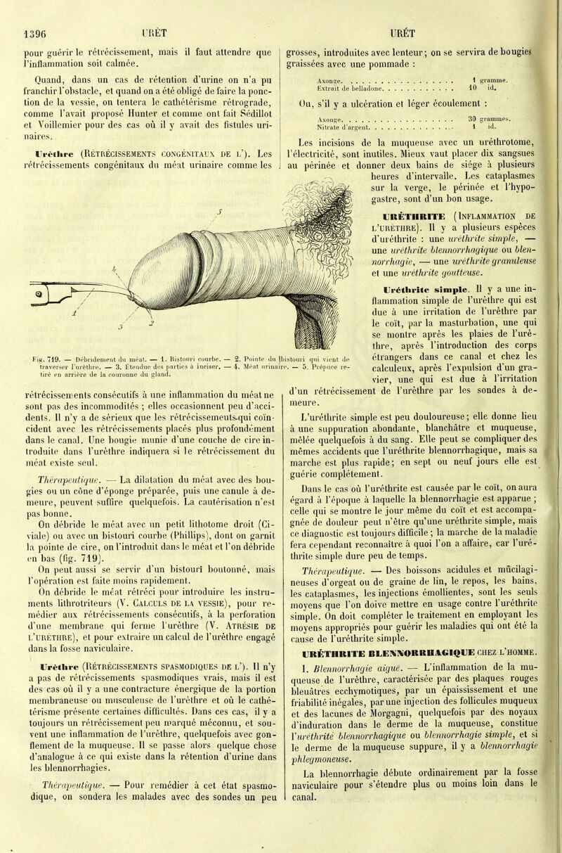 pour guérir le rétrécissement, mais il faut attendre que l'inflammation soit calmée. Quand, dans un cas de rétention d'urine on n'a pu franchir l'obstacle, et quand on a été ol)ligé de faire la ponc- tion de la vessie, on tentera le catliélérisme rétrograde, comme l'avait proposé Hunter et comme ont fait Sédillot et Voillemier pour des cas où il y avait des fistules uri- nai res. Ui-èthre (RÉTIiÉClSSEMENTS CONGÉNIÏA'JX DE l'). Les rétrécissements congénitaux du méat urinaire comme les grosses, introduites aveclenteur; on se servira de bougies graissées avec une pommade : Axoni;e Kxtrait de belladone. 1 giamme. 10 id. Ou, s'il y a ulcération et léger écoulement Axonj^e Nitrate d'arirent. 30 grammes. 1 id. Fiji, 719. — Débridement du méat. — 1. Bistouri courbe. ■ traverser l'iirètliri'. — 3. Étendue des parties il inciser. ■ tiré en arrière de la ronronne du g-land. Pointe du Ibistouri qui vieut de ■ i. Méat urinaire. — 5. Prépuce re- rétrécisseiïjents consécutifs aune inflammation du méat ne sont pas des incommodités ; elles occasionnent peu d'acci- dents. Il n'y a de sérieux que les rétrécissemeuts-qui coïn- cident avec les rétrécissements placés plus profondément dans le canal. Une bougie munie d'une couche de cire in- troduite dans l'urèthre indiquera si le rétrécissement du méat existe seul. Thérapeutique. — La dilatation du méat avec des bou- gies ou un cône d'éponge préparée, puis une canule à de- meure, peuvent suffire quelquefois. La cautérisation n'est pas bonne. On débride le méat avec un petit lilliolome droit (Ci- viale) ou avec un bistouri courbe (Phillips), dont on garnit la pointe de cire, on l'introduit dans le méat et l'on débride en bas (fig. 719). On peut aussi se servir d'un bistouri boutonné, mais l'opération est faite moins rapidement. On débride le méat rétréci pour introduire les instru- ments lithrotriteurs (V. Calculs de la vessie), pour re- médier aux rétrécissements consécutifs, à la perforation d'une membrane qui ferme l'urèthre (V. Atrésie de l'urèthre), et pour extraire un calcul de l'urèthre engagé dans la fosse naviculaire. Crèthrc (1IÉTRÉCISSEMENTS SPASMODIQUES DE l'). Il n'y a pas de rétrécissements spasmodiques vrais, mais il est des cas où il y a une contracture énergique de la portion membraneuse ou musculeusc de l'urèthre et où le cathé- térisme présente certaines difficultés. Dans ces cas, il y a toujours un rétrécissement peu marqué méconnu, et sou- vent une inflammation de l'urèthre, quelquefois avec gon- flement de la muqueuse. 11 se passe alors quelque chose d'analogue à ce qui existe dans la rétention d'urine dans les blennorrhagies. • Thérapeuticjue. — Pour remédier à cet état spasmo- dique, on sondera les malades avec des sondes un peu Les incisions de la muqueuse avec un uréthrotome, l'électricité, sont inutiles. Mieux vaut placer dix sangsues au périnée et donner deux bains de siège à plusieurs heures d'intervalle. Les cataplasmes sur la verge, le périnée et l'hypo- gastre, sont d'un bon usage. URÉTHRITE ( INFLAMIVIATION DE l'urèthre). Il y a plusieurs espèces d'uréthrite : une uréthrite simple, — une uréthrite blennorrhagique ou blen- norrhagie, — une uréthrite granuleuse et une uréthrite goutteuse. Uréthrite simple. 11 y a une in- flammation simple de l'urèthre qui est due à une irritation de l'urèthre par le coït, par la masturbation, une qui se montre après les plaies de l'urè- thre, après l'introduction des corps étrangers dans ce canal et chez les calculeux, après l'expulsion d'un gra- vier, une qui est due à l'irritation d'un rétrécissement de l'urèthre par les sondes à de- meure. L'uréthrite simple est peu douloureuse ; elle donne lieu à une suppuration abondante, blanchâtre et muqueuse, mêlée quelquefois à du sang. Elle peut se compliquer des mêmes accidents que l'uréthrite blennorrhagique, mais sa marche est plus rapide; en sept ou neuf jours elle est guérie complètement. Dans le cas où l'uréthrite est causée par le coït, on aura égard à l'époque à laquelle la blennorrhagie est apparue ; celle qui se montre le jour même du coït et est accompa- gnée de douleur peut n'être qu'une uréthrite simple, mais ce diagnostic est toujours difficile ; la marche de la maladie fera cependant reconnaître à quoi l'on a affaire, car l'uré- thrite simple dure peu de temps. Thérapeutique. — Des boissons acidulés et miîcilagi- neuses d'orgeat ou de graine de lin, le repos, les bains, les cataplasmes, les injections émollientes, sont les seuls moyens que l'on doive mettre en usage contre l'uréthrite simple. On doit compléter le traitement en employant les moyens appropriés pour guérir les maladies qui ont été la cause de l'uréthrite simple. URÉTHRITE BLE»!l\;ORRHAGIQUE CHEZ L HOMME. I. Blennorrhagie aiguë. — L'inflammation de la mu- queuse de l'urèthre, caractérisée par des plaques rouges bleuâtres ecchymotiques, par un épaississement et une friabilité inégales, par une injection des follicules muqueux et des lacunes de Morgagni, quelquefois par des noyaux d'induration dans le derme de la muqueuse, constitue l'uréthrite blennorrhagique ou blennorrhagie simple, et si le derme de la muqueuse suppure, il y a blennorrhagie phlegmoneuse. La blennorrhagie débute ordinairement par la fosse naviculaire pour s'étendre plus ou moins loin dans le canal.