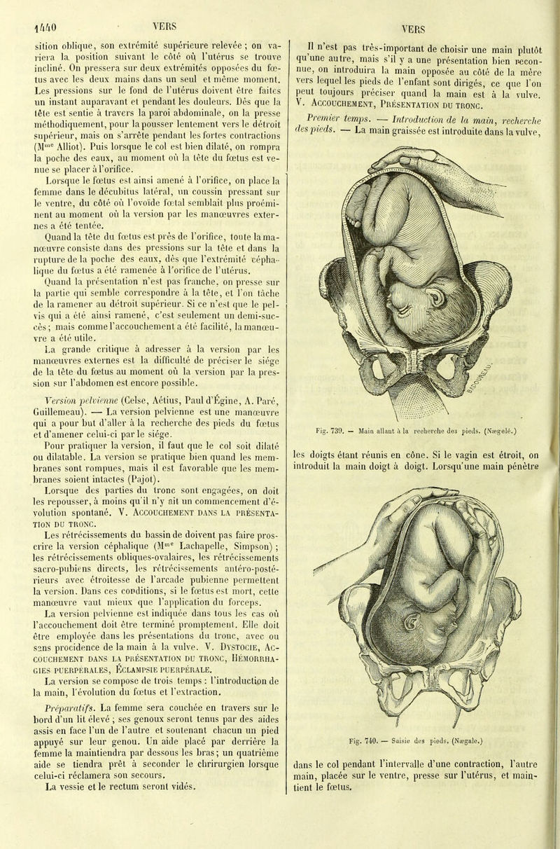 sition oblique, son extrémité supérieure relevée; on va- rieia la position suivant le côté où l'utérus se trouve incliné. On pressera sur deux extrémités opposées du fœ- tus avec les deux mains dans un seul et même moment. Les pressions sur le fond de l'utérus doivent être faites un instant auparavant et pendant les douleurs. Dès que la tête est sentie à travers la paroi abdominale, on la presse méthodiquement, pour la pousser lentement vers le détroit supérieur, mais on s'arrête pendant les fortes contractions (M' Alliot). Puis lorsque le col est bien dilaté, on rompra la poche des eaux, au moment où la tête du fœtus est ve- nue se placer à l'orifice. Lorsque le fœtus est ainsi amené à l'orifice, on place la femme dans le décubitus latéral, un coussin pressant sur le ventre, du côté où l'ovoïde fœtal semblait plus proémi- nent au moment où la version par les manœuvres exter- nes a été tentée. Quand la tête du fœtus est près de l'orifice, toute la ma- nœuvre consiste dans des pressions sur la tête et dans la rupture de la poche des eaux, dès que l'extrémité cépha - lique du fœtus a été ramenée à l'orifice de l'utérus. Quand la présentation n'est pas franche, on presse sur la partie qui semble correspondre à la tête, et l'on tâche de la ramener au détroit supérieur. Si ce n'est que le pel- vis qui a été ainsi ramené, c'est seulement un demi-suc- cès; mais comme l'accouchement a été facilité, iamanœu- vre a été utile. La grande critique à adresser à la version par les manœuvres externes est la difficulté de préciser le siège de la tête du fœtus au moment où la version par la pres- sion sur l'abdomen est encore possible. Version pclvimne (Celse, Aétius, Paul d'Égine, A. Paré, Guillemeau). —La version pelvienne est une manœuvre qui a pour but d'aller à la recherche des pieds du fœtus et d'amener celui-ci parle siège. Pour pratiquer la version, il faut que le col soit dilaté ou dilatable. La versiou se pratique bien quand les mem- branes sont rompues, mais il est favorable que les mem- branes soient intactes (Pajot). Lorsque des parties du tronc sont engagées, on doit les repousser, à moins qu'il n'y ait im commencement d'é- volution spontané. V. Accouchement d.vns la présenta- tion DU TRONC. Les rétrécissements du bassin de doivent pas faire pros- crire la version céphalique (M Lachapelle, Simpson) ; les rétrécissements obliques-ovalaires, les rétrécissements sacro-pubiens directs, les rétrécissements antéro-posté- rieurs avec étroitesse de l'arcade pubienne permettent la version. Dans ces conditions, si le fœtus est mort, cette manœuvre vaut mieux que l'application du foixeps. La version pelvienne est indiquée dans tous les cas où l'accouchement doit être terminé promptement. Elle doit être employée dans les présentations du tronc, avec ou sans procidence de la main à la vulve. V. Dystocie, Ac- couchement DANS LA présentation DU TRONC, IIÉMORRHA- GIES PUERPERALES, KCLAMPSIE PUERPÉRALE. La version se compose de trois temps : l'introduction de la main, l'évolution du fœtus et l'extraction. Pi'éparatïfs. La femme sera couchée en travers sur le bord d'un lit élevé ; ses genoux seront tenus par des aides assis en face l'un de l'autre et soutenant chacun un pied appuyé sur leur genou. Un aide placé par derrière la femme la maintiendra par dessous les bras; un quatrième aide se tiendra prêt à seconder le chrirurgien lorsque celui-ci réclamera son secours. La vessie et le rectum seront vidés. Il n'est pas très-important de choisir une main plutôt qu'une autre, mais s'il y a une présentation bien recon- nue, on introduira la main opposée au côté de la mère vers lequel les pieds de l'enfant sont dirigés, ce que l'on peut toujours préciser quand la main est à la vulve. V. Accouchement, Présentation du tronc. Premier ternies. — Introduction de la main, recherche des pieds. — La main graissée est introduite dans la vulve, \ Fig. 739. — Main allaQt ù la recherche des pieds. (N;egelé.) les doigts étant réunis en cône. Si le vagin est étroit, on introduit la main doigt à doigt. Lorsqu'une main pénètre Fig. 7-40. — Saisie des pieds, (Naîgale.) dans le col pendant l'intervalle d'une contraction, l'autre main, placée sur le ventre, presse sur l'utérus, et main- tient le fœtus.