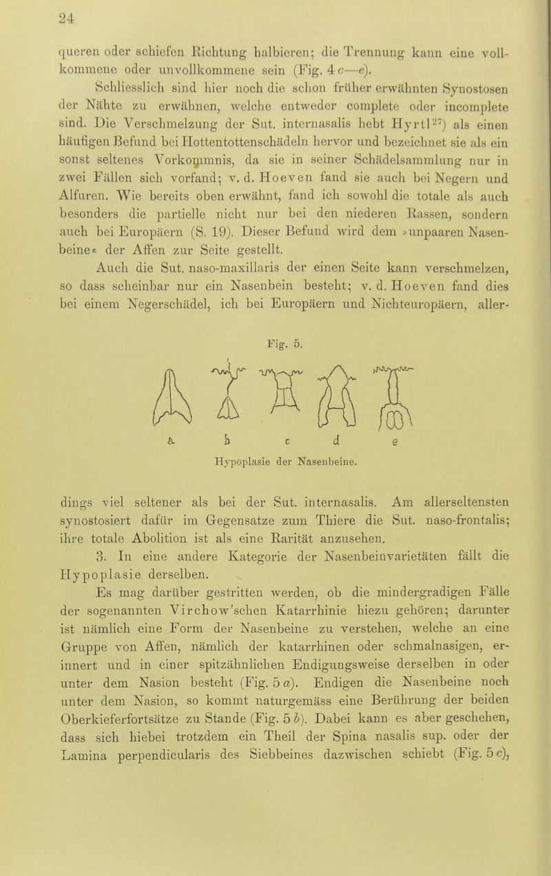 queren oder schiefen Richtung halbieren; die Trennung kann eine voll- kommene oder unvollkommene sein (Fig. 4 c—e). Schliesslich sind hier noch die schon früher erwähnten Synostosen der Nähte zu erwähnen, welche entweder complete oder incomplete sind. Die Verschmelzung der Sut. internasalis hebt Hyrtl27) als einen häufigen Befund bei Hottentottenschädeln hervor und bezeichnet sie als ein sonst seltenes Vorkommnis, da sie in seiner Schädelsammlung nur in zwei Fällen sich vorfand-, v. d. Hoeven fand sie auch bei Negern und Alfuren. Wie bereits oben erwähnt, fand ich sowohl die totale als auch besonders die partielle nicht nur bei den niederen Rassen, sondern auch bei Europäern (S. 19). Dieser Befund wird dem »unpaaren Nasen- beine« der Affen zur Seite gestellt. Auch die Sut. naso-maxillaris der einen Seite kann verschmelzen, so dass scheinbar nur ein Nasenbein besteht; v. d. Hoeven fand dies bei einem Negerschädel, ich bei Europäern und Nichteuropäern, aller- Fig. 5. 6. b c d e Hypoplasie der Nasenbeine. dings viel seltener als bei der Sut. internasalis. Am allerseltensten synostosiert dafür im Gegensatze zum Thiere die Sut. naso-frontalis; ihre totale Abolition ist als eine Rarität anzusehen. 3. In eine andere Kategorie der Nasenbeinvarietäten fällt die Hypoplasie derselben. Es mag darüber gestritten werden, ob die mindergradigen Fälle der sogenannten Virchow'sehen Katarrhinie hiezu gehören; darunter ist nämlich eine Form der Nasenbeine zu verstehen, welche an eine Gruppe von Affen, nämlich der katarrhinen oder schmalnasigen, er- innert und in einer spitzähnlichen Endigungsweise derselben in oder unter dem Nasion besteht (Fig. 5 a). Endigen die Nasenbeine noch unter dem Nasion, so kommt naturgemäss eine Berührung der beiden Oberkieferfortsätze zu Stande (Fig. 5 h). Dabei kann es aber geschehen, dass sich hiebei trotzdem ein Theil der Spina nasalis sup. oder der Lamina perpendicularis des Siebbeines dazwischen schiebt (Fig. 5 c),
