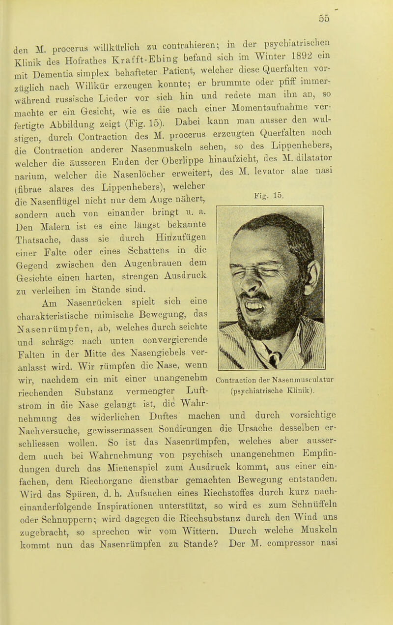 Fig. 15. den M procerus willkürlich zu contrahieren; in der psychiatrischen Klinik des Hofrathes Krafft-Ebing befand sich im Winter 1892 ein mit Dementia simples behafteter Patient, welcher diese Querfalten vor- züglich nach Willkür erzeugen konnte; er brummte oder pfiff immer- während russische Lieder vor sich hin und redete man ihn an, so machte er ein Gesicht, wie es die nach einer Momentaufnahme ver- fertigte Abbildung zeigt (Fig. 15). Dabei kann man ausser den wul- stigen durch Contraction des M. procerus erzeugten Querfalten noch die° Contraction anderer Nasenmuskeln sehen, so des Lippenhebers, welcher die äusseren Enden der Oberlippe hinaufzieht, des M. dilatator narium, welcher die Nasenlöcher erweitert, des M. levator alae nasi (fibrae alares des Lippenhebers), welcher die Nasenflügel nicht nur dem Auge nähert, sondern auch von einander bringt u. a. Den Malern ist es eine längst bekannte Thatsache, dass sie durch Hinzufügen einer Falte oder eines Schattens in die Gegend zwischen den Augenbrauen dem Gesichte einen harten, strengen Ausdruck zu verleihen im Stande sind. Am Nasenrücken spielt sich eine charakteristische mimische Bewegung, das Nasenrümpfen, ab, welches durch seichte und schräge nach unten convergierende Falten in der Mitte des Nasengiebels ver- anlasst wird. Wir rümpfen die Nase, wenn wir, nachdem ein mit einer unangenehm contraction der Nasenmusculatur riechenden Substanz vermengter Luft- (psychiatrische Klinik), ström in die Nase gelangt ist, die Wahr- nehmung des widerlichen Duftes machen und durch vorsichtige Nachversuche, gewissermassen Sondirungen die Ursache desselben er- schliessen wollen. So ist das Nasenrümpfen, welches aber ausser- dem auch bei Wahrnehmung von psychisch unangenehmen Empfin- dungen durch das Mienenspiel zum Ausdruck kommt, aus einer ein- fachen, dem Riechorgane dienstbar gemachten Bewegung entstanden. Wird das Spüren, d. h. Aufsuchen eines Riechstoffes durch kurz nach- einanderfolgende Inspirationen unterstützt, so wird es zum Schnüffeln oder Schnuppern; wird dagegen die Riechsubstanz durch den Wind uns zugebracht, so sprechen wir vom Wittern. Durch welche Muskeln kommt nun das Nasenrümpfen zu Stande? Der M. compressor nasi