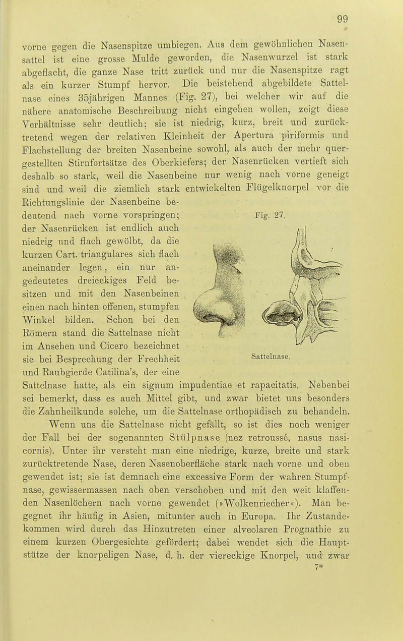 vorne gegen die Nasenspitze umbiegen. Aus dem gewöhnlichen Nasen- sattel ist eine grosse Mulde geworden, die Nasenwurzel ist stark abgeflacht, die ganze Nase tritt zurück und nur die Nasenspitze ragt als ein kurzer Stumpf hervor. Die beistehend abgebildete Sattel- nase eines 35jährigen Mannes (Fig. 27), bei welcher wir auf die nähere anatomische Beschreibung nicht eingehen wollen, zeigt diese Verhältnisse sehr deutlich; sie ist niedrig, kurz, breit und zurück- tretend wegen der relativen Kleinheit der Apertura piriformis und Flachstellung der breiten Nasenbeine sowohl, als auch der mehr quer- gestellten Stirnfortsätze des Oberkiefers; der Nasenrücken vertieft sich deshalb so stark, weil die Nasenbeine nur wenig nach vorne geneigt sind und weil die ziemlich stark entwickelten Flügelknorpel vor die Richtungslinie der Nasenbeine be- deutend nach vorne vorspringen;' Fig. 27. der Nasenrücken ist endlich auch niedrig und flach gewölbt, da die kurzen Cart. trianguläres sich flach aneinander legen, ein nur an- gedeutetes dreieckiges Feld be- sitzen und mit den Nasenbeinen einen nach hinten offenen, stumpfen Winkel bilden. Schon bei den Römern stand die Sattelnase nicht im Ansehen und Cicero bezeichnet sie bei Besprechung der Frechheit und Raubgierde Catilina's, der eine Sattelnase hatte, als ein signum impudentiae et rapaeitatis. Nebenbei sei bemerkt, dass es auch Mittel gibt, und zwar bietet uns besonders die Zahnheilkunde solche, um die Sattelnase orthopädisch zu behandeln. Wenn uns die Sattelnase nicht gefällt, so ist dies noch weniger der Fall bei der sogenannten Stülpnase (nez retrousse, nasus nasi- cornis). Unter ihr versteht man eine niedrige, kurze, breite und stark zurücktretende Nase, deren Nasenoberfläche stark nach vorne und oben gewendet ist; sie ist demnach eine excessive Form der wahren Stumpf- nase, gewissermassen nach oben verschoben und mit den weit klaffen- den Nasenlöchern nach vorne gewendet (»Wolkenriecher«). Man be- gegnet ihr häufig in Asien, mitunter auch in Europa. Ihr Zustande- kommen wird durch das Hinzutreten einer alveolaren Prognathie zu einem kurzen Obergesichte gefördert; dabei wendet sich die Haupt- stütze der knorpeligen Nase, d. h. der viereckige Knorpel, und zwar 7* Sattelnase.