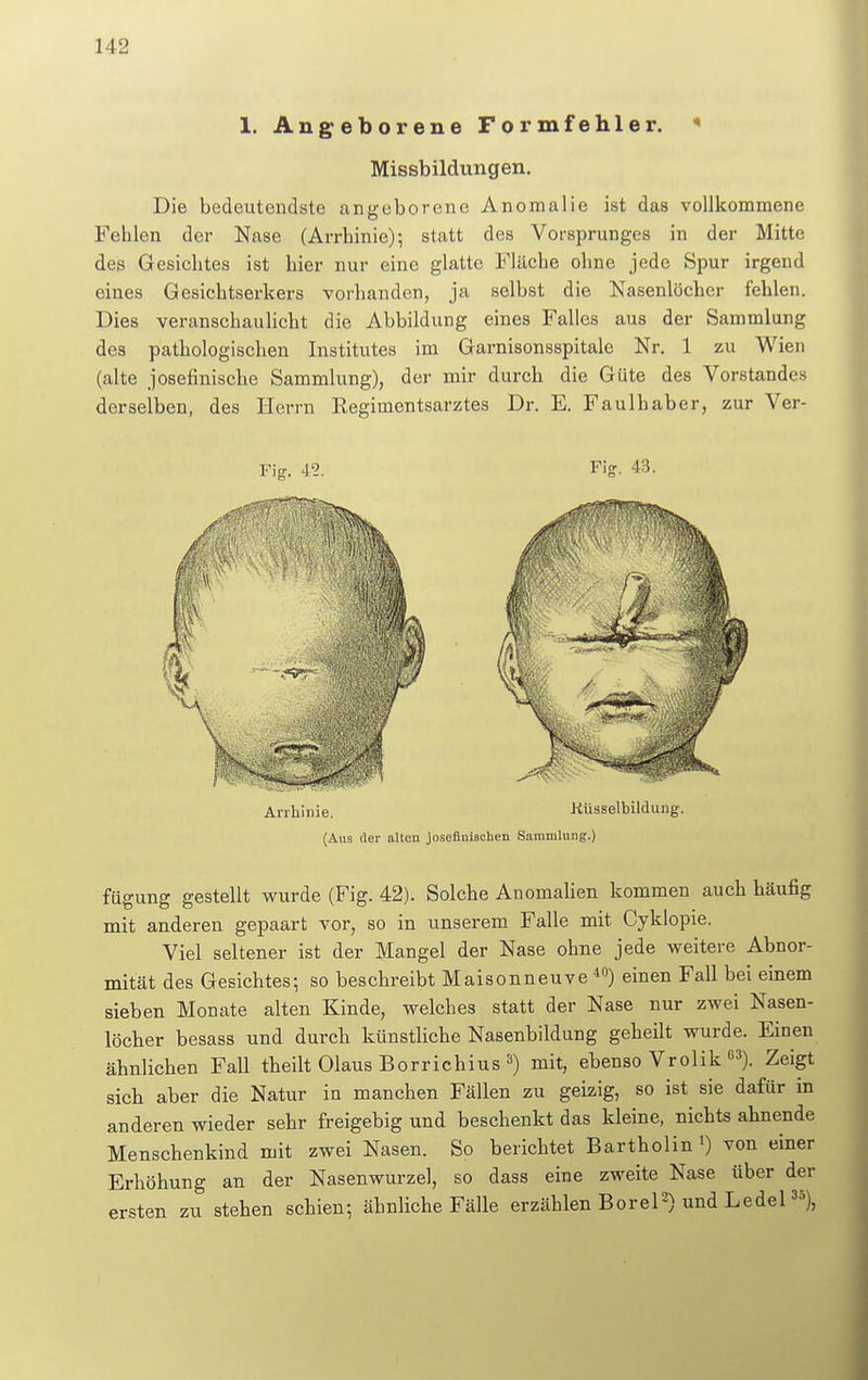 1. Angeborene Formfehler. * Missbildungen. Die bedeutendste angeborene Anomalie ist das vollkommene Fehlen der Nase (Arrhinie); statt des Vorsprunges in der Mitte des Gesichtes ist hier nur eine glatte Fläche ohne jede Spur irgend eines Gesichtserkers vorhanden, ja selbst die Nasenlöcher fehlen. Dies veranschaulicht die Abbildung eines Falles aus der Sammlung des pathologischen Institutes im Garnisonsspitale Nr. 1 zu Wien (alte josefinische Sammlung), der mir durch die Güte des Vorstandes derselben, des Herrn Regimentsarztes Dr. E. Faulbaber, zur Ver- fügung gestellt wurde (Fig. 42). Solche Anomalien kommen auch häufig mit anderen gepaart vor, so in unserem Falle mit Cyklopie. Viel seltener ist der Mangel der Nase ohne jede weitere Abnor- mität des Gesichtes; so beschreibt Maisonneuve 40) einen Fall bei einem sieben Monate alten Kinde, welches statt der Nase nur zwei Nasen- löcher besass und durch künstliche Nasenbildung geheilt wurde. Einen ähnlichen Fall theilt Olaus Borrichius 3) mit, ebenso Vrolik G3). Zeigt sich aber die Natur in manchen Fällen zu geizig, so ist sie dafür in anderen wieder sehr freigebig und beschenkt das kleine, nichts ahnende Menschenkind mit zwei Nasen. So berichtet Bartholin l) von einer Erhöhung an der Nasenwurzel, so dass eine zweite Nase über der ersten zu stehen schien; ähnliche Fälle erzählen Borel2) und Ledel35),