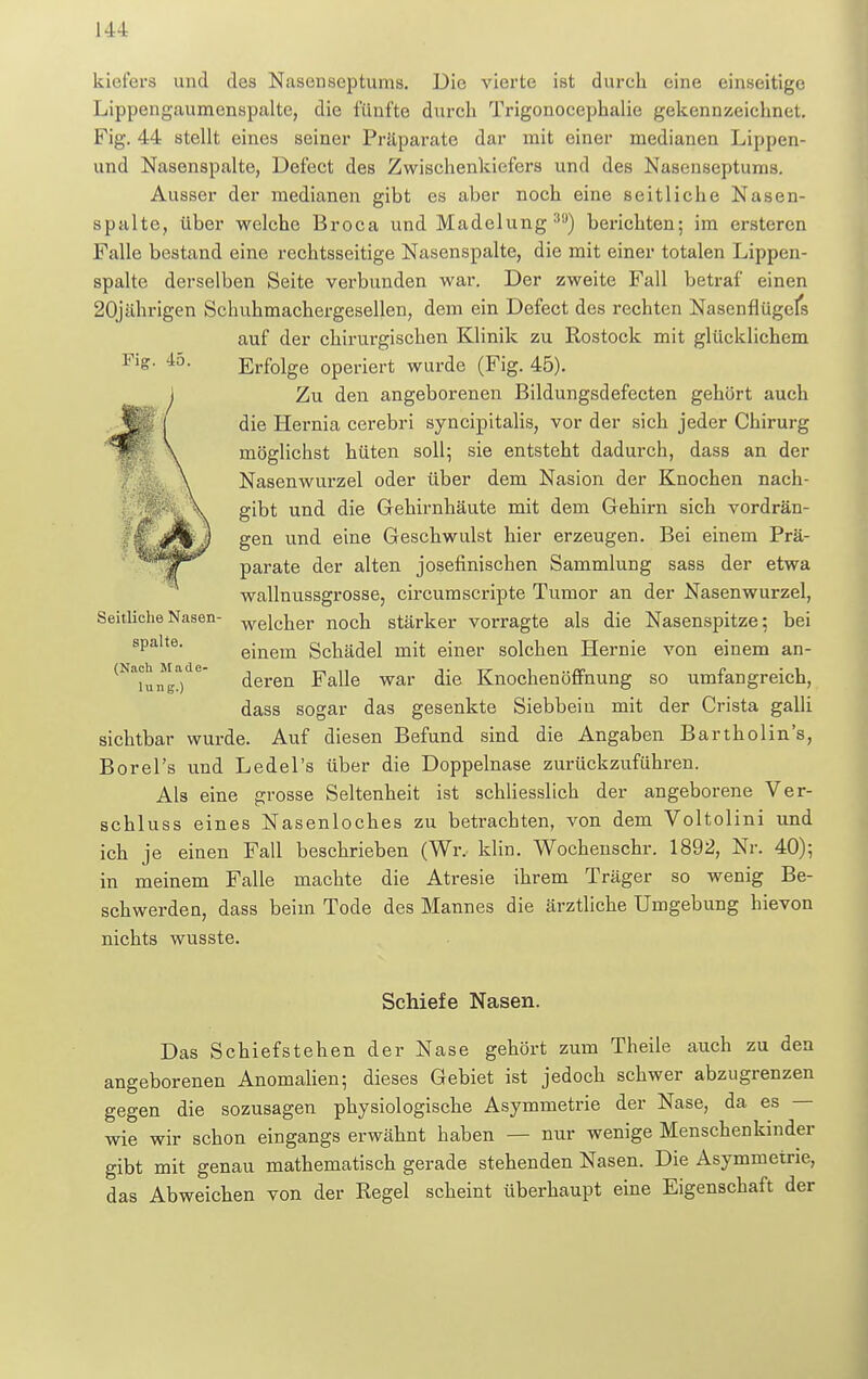 Fig. 45. kieferä und des Nasenseptums. Die vierte ist durch eine einseitige Lippcngaumenspalte, die fünfte durch Trigonocephalie gekennzeichnet. Fig. 44 stellt eines seiner Präparate dar mit einer medianen Lippen- und Nasenspalte, Defect des Zwischenkiefers und des Nasenseptums. Ausser der medianen gibt es aber noch eine seitliche Nasen- spalte, über welche Broca und Madelung39) berichten; im ersteren Falle bestand eine rechtsseitige Nasenspalte, die mit einer totalen Lippen- spalte derselben Seite verbunden war. Der zweite Fall betraf einen 20jährigen Schuhmachergesellen, dem ein Defect des rechten Nasenflügels auf der chirurgischen Klinik zu Rostock mit glücklichem Erfolge operiert wurde (Fig. 45). Zu den angeborenen Bildungsdefecten gehört auch die Hernia cerebri syncipitalis, vor der sich jeder Chirurg möglichst hüten soll; sie entsteht dadurch, dass an der Nasenwurzel oder über dem Nasion der Knochen nach- gibt und die Gehirnhäute mit dem Gehirn sich vordrän- gen und eine Geschwulst hier erzeugen. Bei einem Prä- parate der alten josefinischen Sammlung sass der etwa wallnussgrosse, circum Scripte Tumor an der Nasenwurzel, welcher noch stärker vorragte als die Nasenspitze; bei einem Schädel mit einer solchen Hernie von einem an- deren Falle war die Knochen Öffnung so umfangreich, dass sogar das gesenkte Siebbein mit der Crista galli sichtbar wurde. Auf diesen Befund sind die Angaben Bartholin's, Borel's und Ledel's über die Doppelnase zurückzuführen. Als eine grosse Seltenheit ist schliesslich der angeborene Ver- schluss eines Nasenloches zu betrachten, von dem Voltolini und ich je einen Fall beschrieben (Wr. klin. Wochenschr. 1892, Nr. 40); in meinem Falle machte die Atresie ihrem Träger so wenig Be- schwerden, dass beim Tode des Mannes die ärztliche Umgebung hievon nichts wusste. Seitliche Nasen- spalte. (Nach Made- lung.) Schiefe Nasen. Das Schiefstehen der Nase gehört zum Theile auch zu den angeborenen Anomalien; dieses Gebiet ist jedoch schwer abzugrenzen gegen die sozusagen physiologische Asymmetrie der Nase, da es — wie wir schon eingangs erwähnt haben — nur wenige Menschenkinder gibt mit genau mathematisch gerade stehenden Nasen. Die Asymmetrie, das Abweichen von der Regel scheint überhaupt eine Eigenschaft der