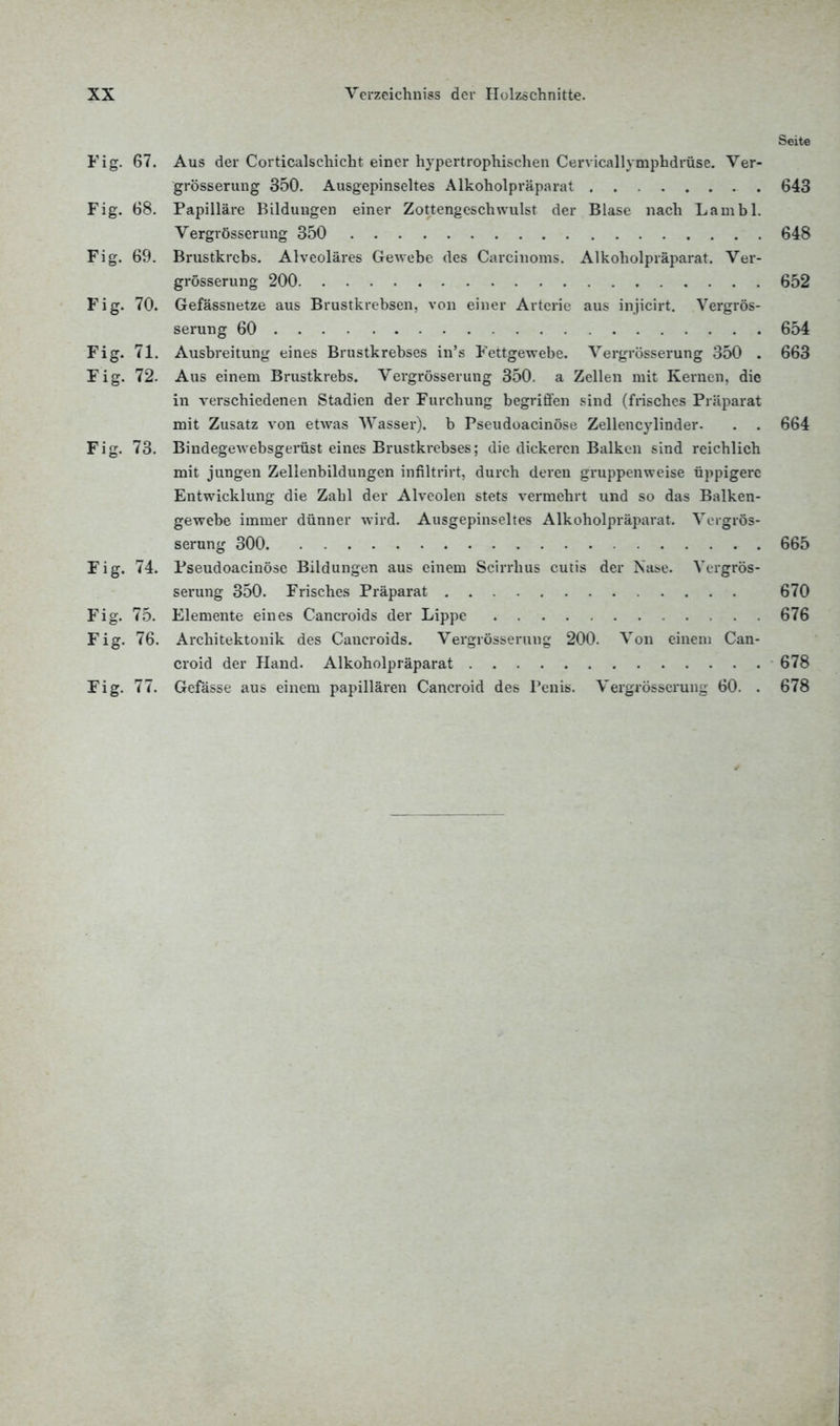 Seite Fig. 67. Aus der Corticalschicht einer hypertrophischen Cervicallymphdrüse. Ver- grösserung 350. Ausgepinseltes Alkoholpräparat 643 Fig. 68. Papilläre Bildungen einer Zottengeschwulst der Blase nach Lambl. Vergrößerung 350 648 Fig. 69. Brustkrebs. Alveoläres Gewebe des Carcinoms. Alkoholpräparat. Ver- grösserung 200 652 Fig. 70. Gefässnetze aus Brustkrebsen, von einer Arterie aus injicirt. Vergrös- serung 60 654 Fig. 71. Ausbreitung eines Brustkrebses in's Fettgewebe. Vergrösserung 350 . 663 Fig. 72. Aus einem Brustkrebs. Vergrösserung 350. a Zellen mit Kernen, die in verschiedenen Stadien der Furchung begriffen sind (frisches Präparat mit Zusatz von etwas Wasser), b Pseudoacinöse Zellencvlinder- . . 664 Fig. 73. Bindegewebsgerüst eines Brustkrebses; die dickeren Balken sind reichlich mit jungen Zellenbildungen inftltrirt, durch deren gruppenweise üppigere Entwicklung die Zahl der Alveolen stets vermehrt und so das Balken- gewebe immer dünner wird. Ausgepinseltes Alkoholpräparat. Vergrös- serung 300 665 Fig. 74. Pseudoacinöse Bildungen aus einem Scirrhus cutis der Nase. Vergrös- serung 350. Frisches Präparat 670 Fig. 75. Elemente eines Cancroids der Lippe 676 Fig. 76. Architektonik des Caucroids. Vergrösserung 200. Von einem Can- croid der Hand. Alkoholpräparat 678 Fig. 77. Gefässe aus einem papillären Cancroid des Penis. Vergrösserung 60. . 678